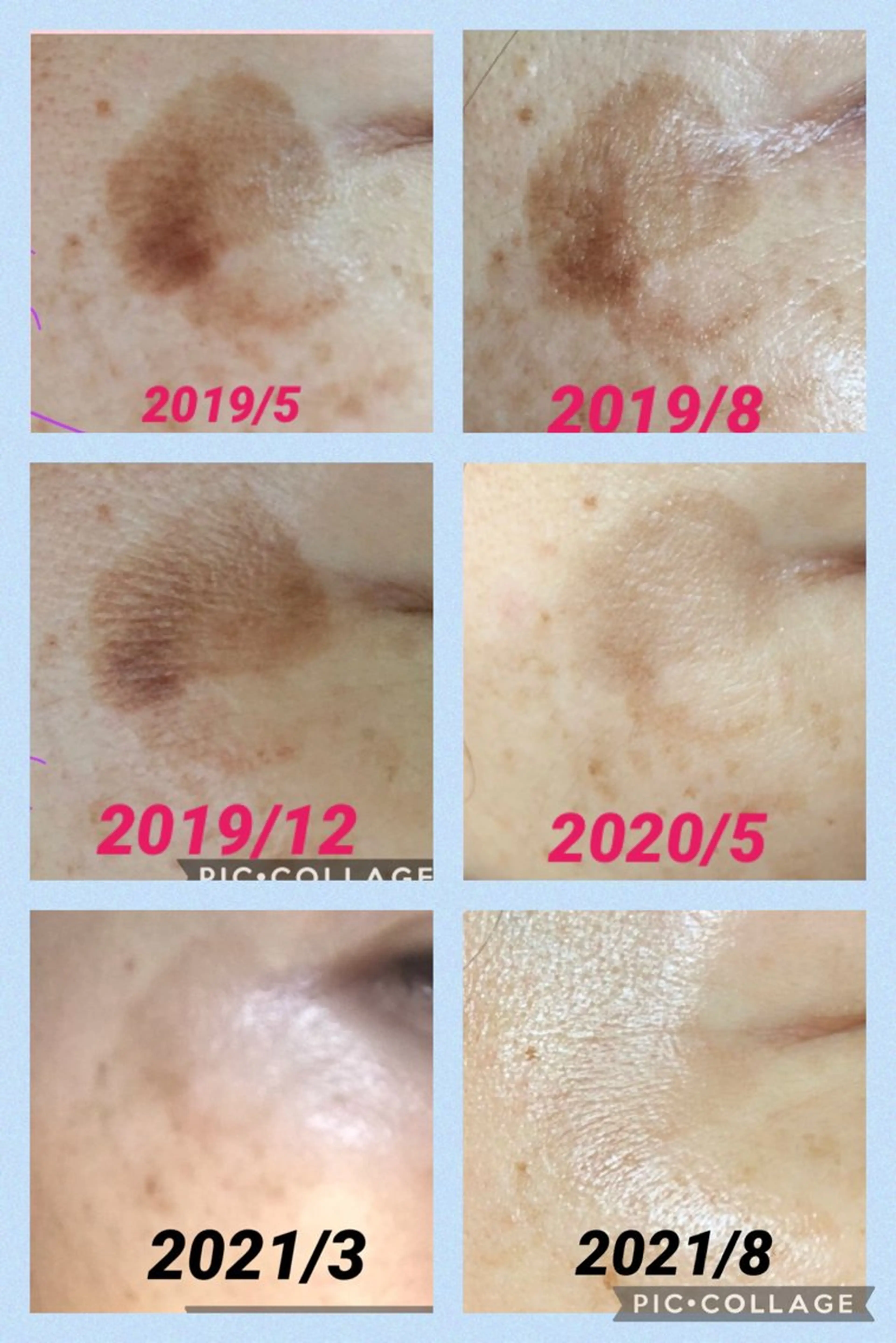 メナードフェイシャル サロンmakiのエステ・リラクイメージ