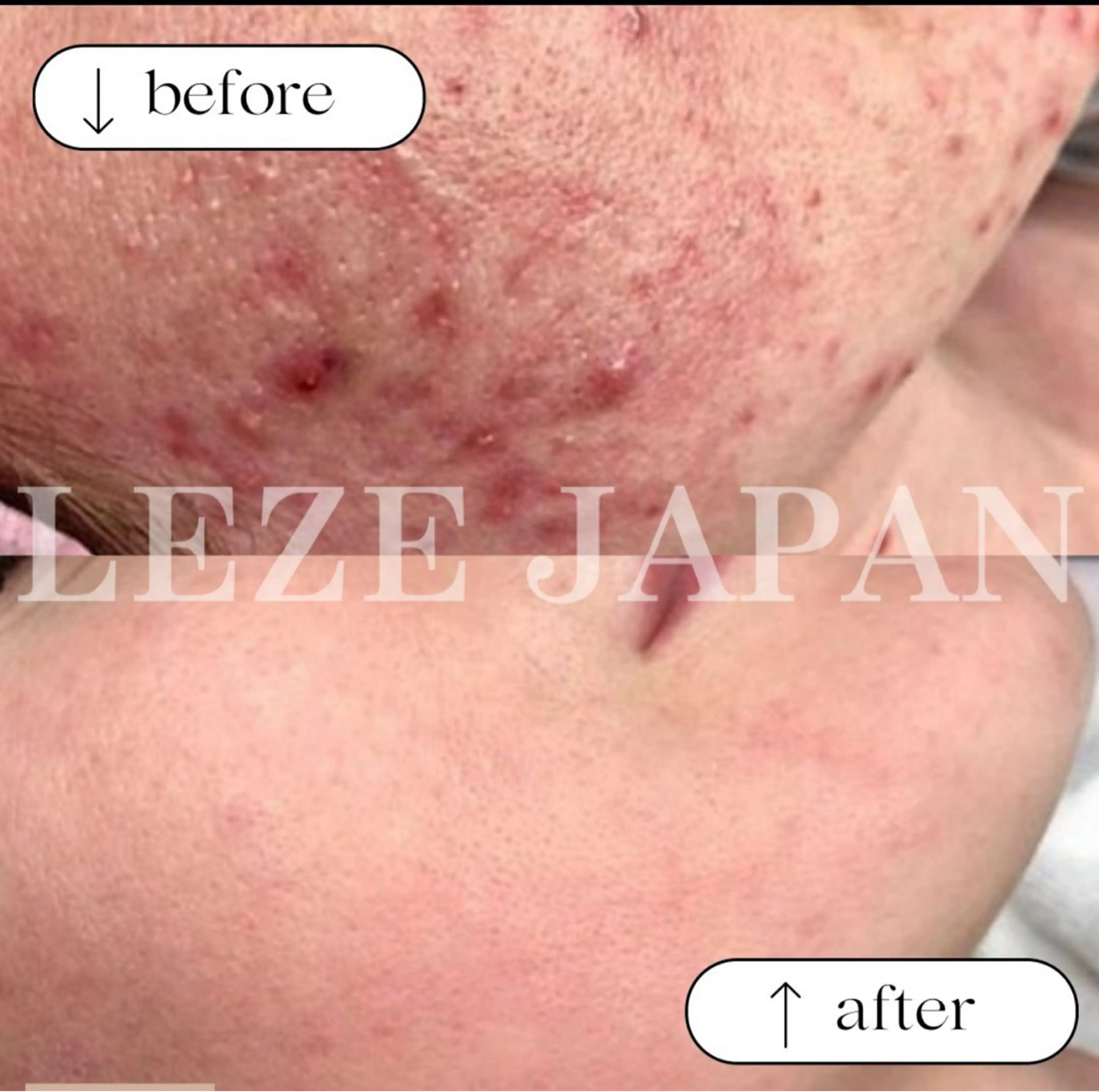 エステ 桐山 まどかのその他イメージ