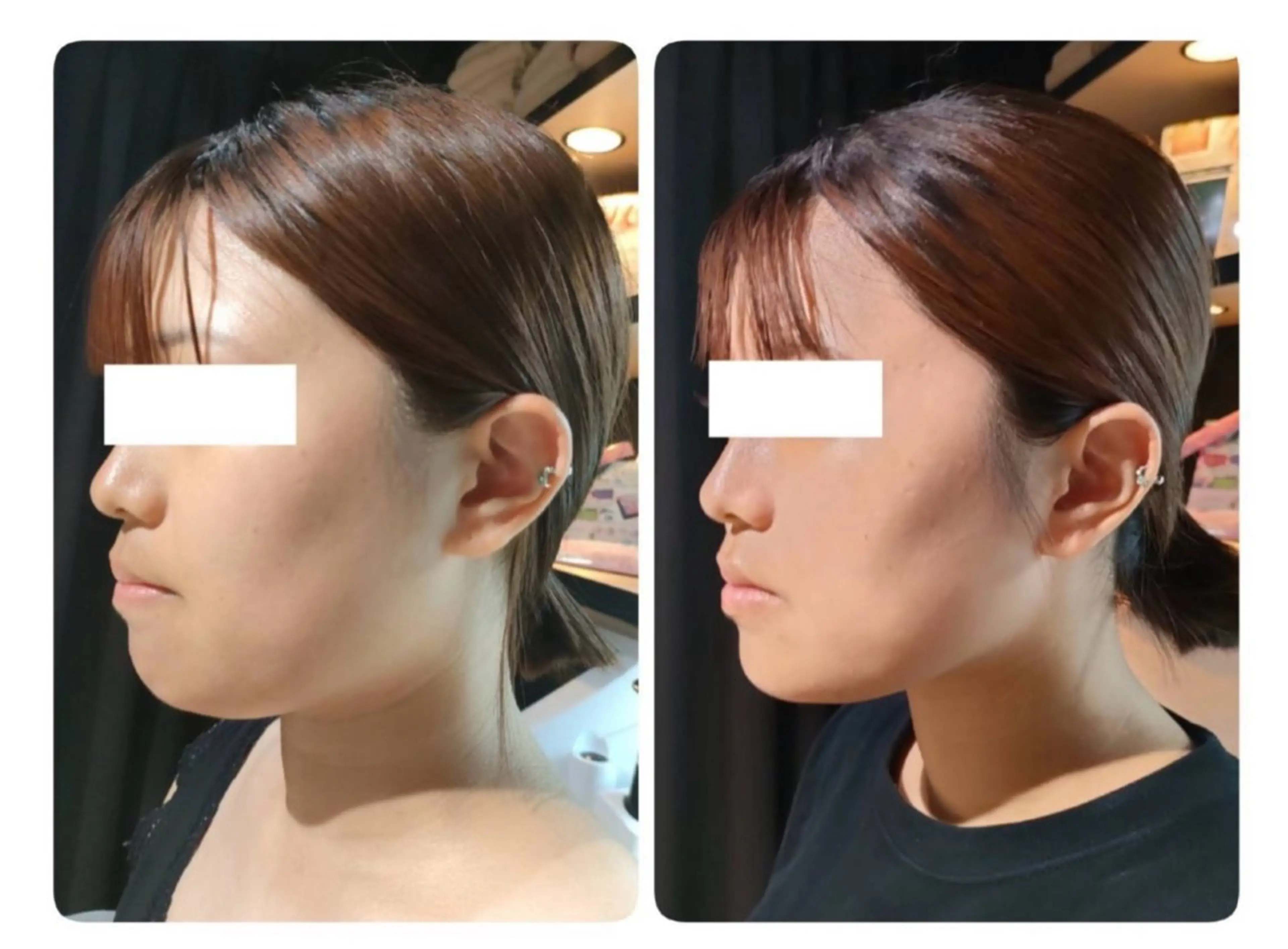 beautysalon DiAViM所属・本格コルギ美肌美眉 DiAViM 💎のエステ・リラクイメージ