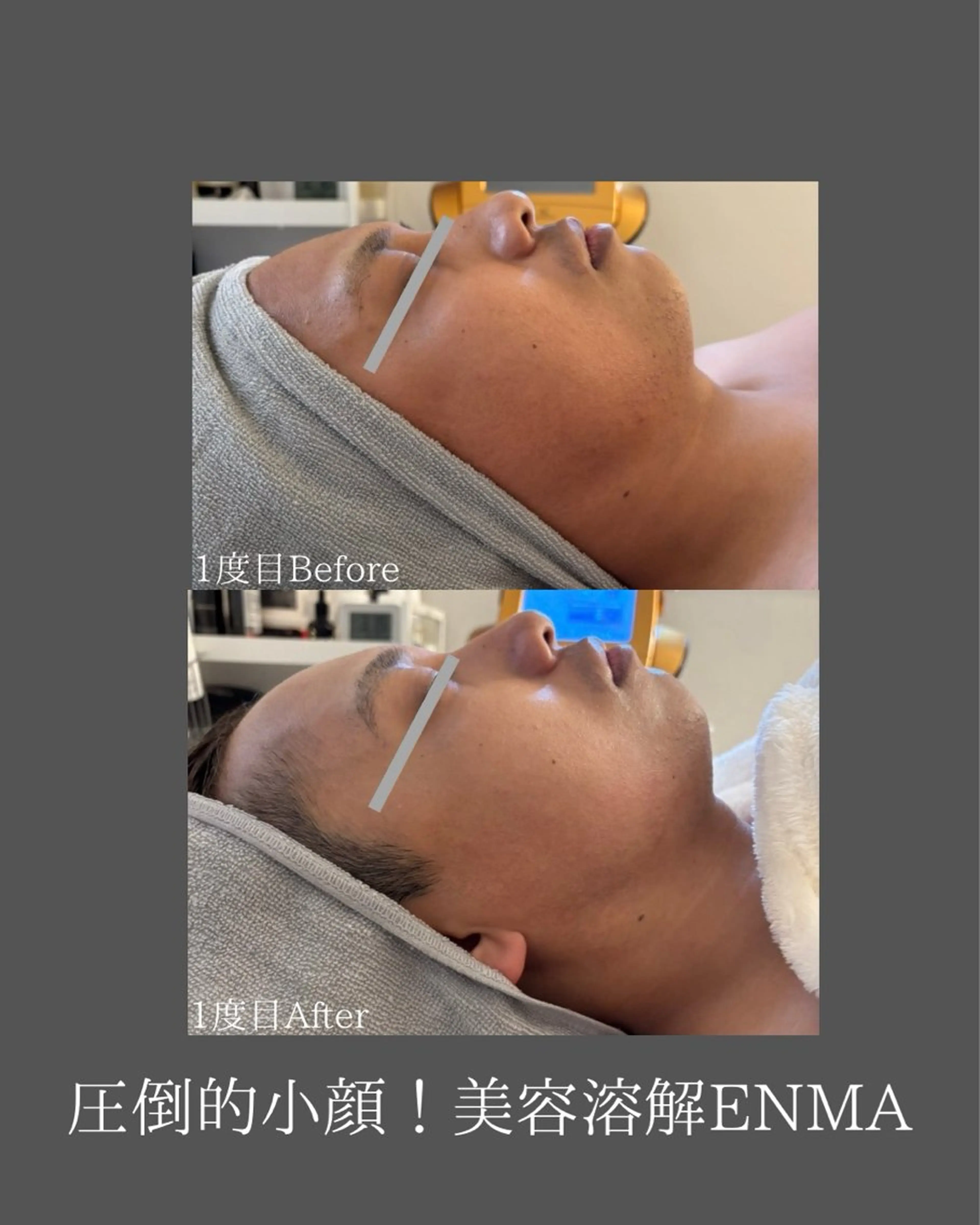 BLOSSOM 菊地のエステ・リラクイメージ