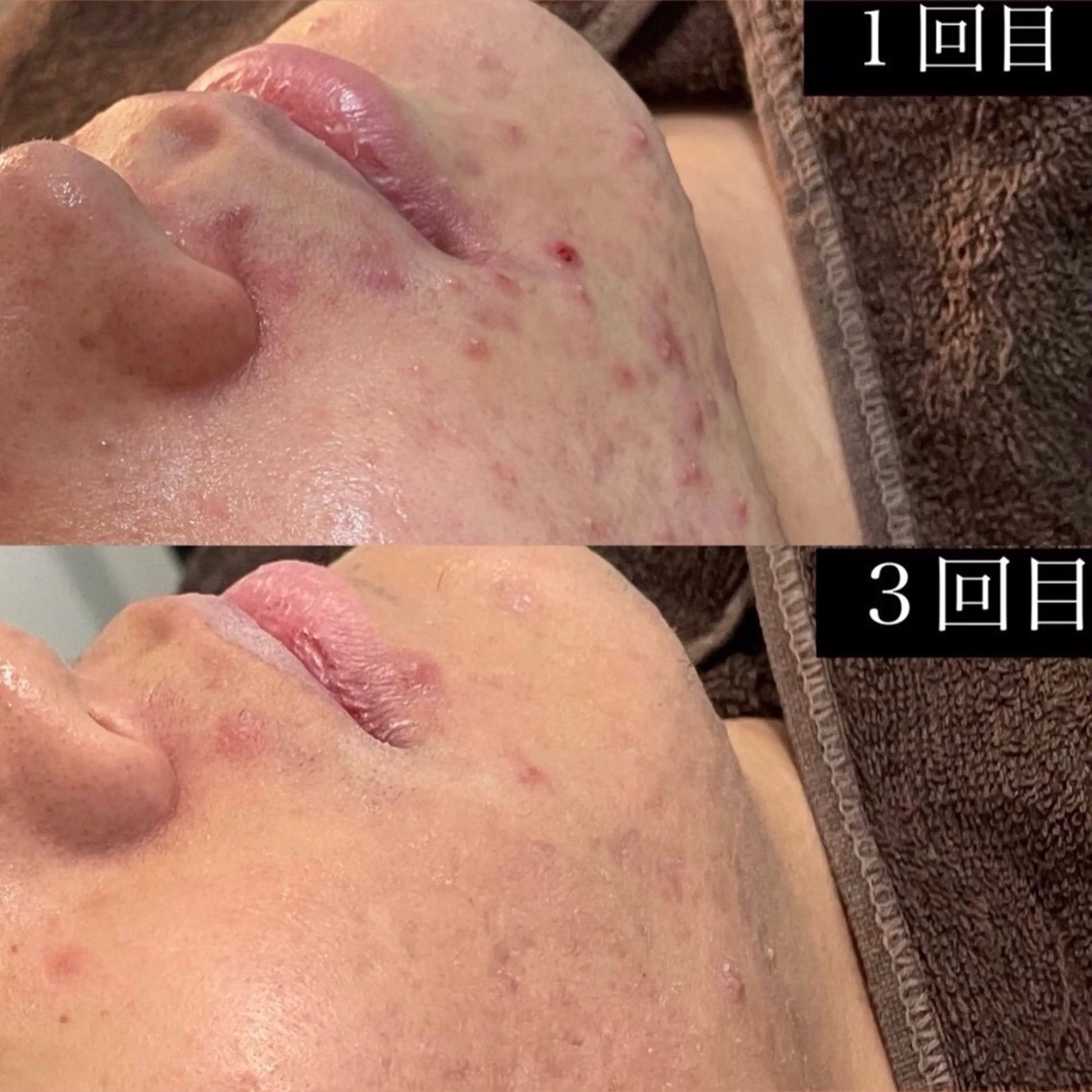 メンズ エステ 韓国肌管理Belle静岡所属・Belle静岡 稲葉のエステ・リラクイメージ