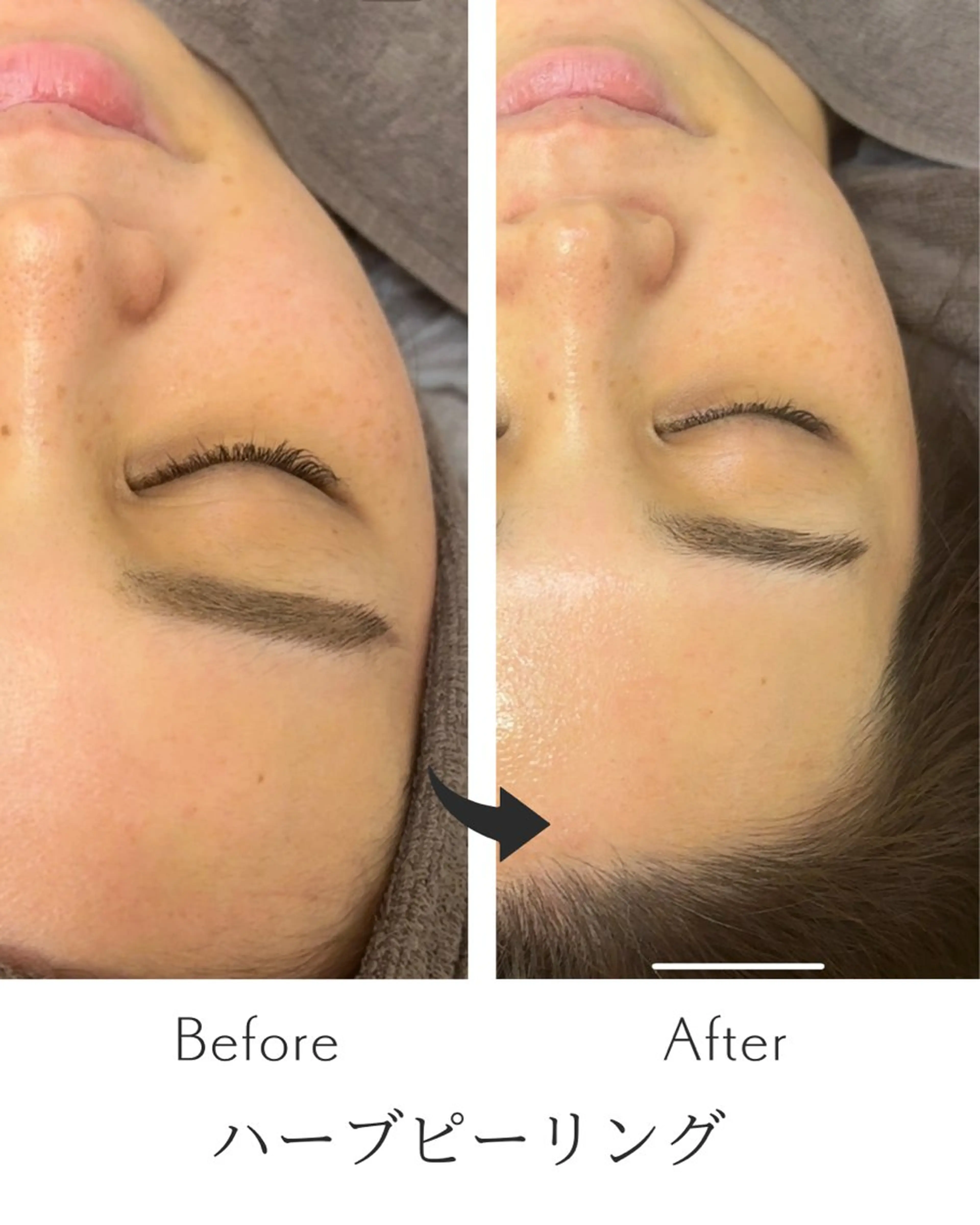 市川本八幡リーフ整骨院所属・女性のための鍼灸師 かえで𓎤𓅮のエステ・リラクイメージ