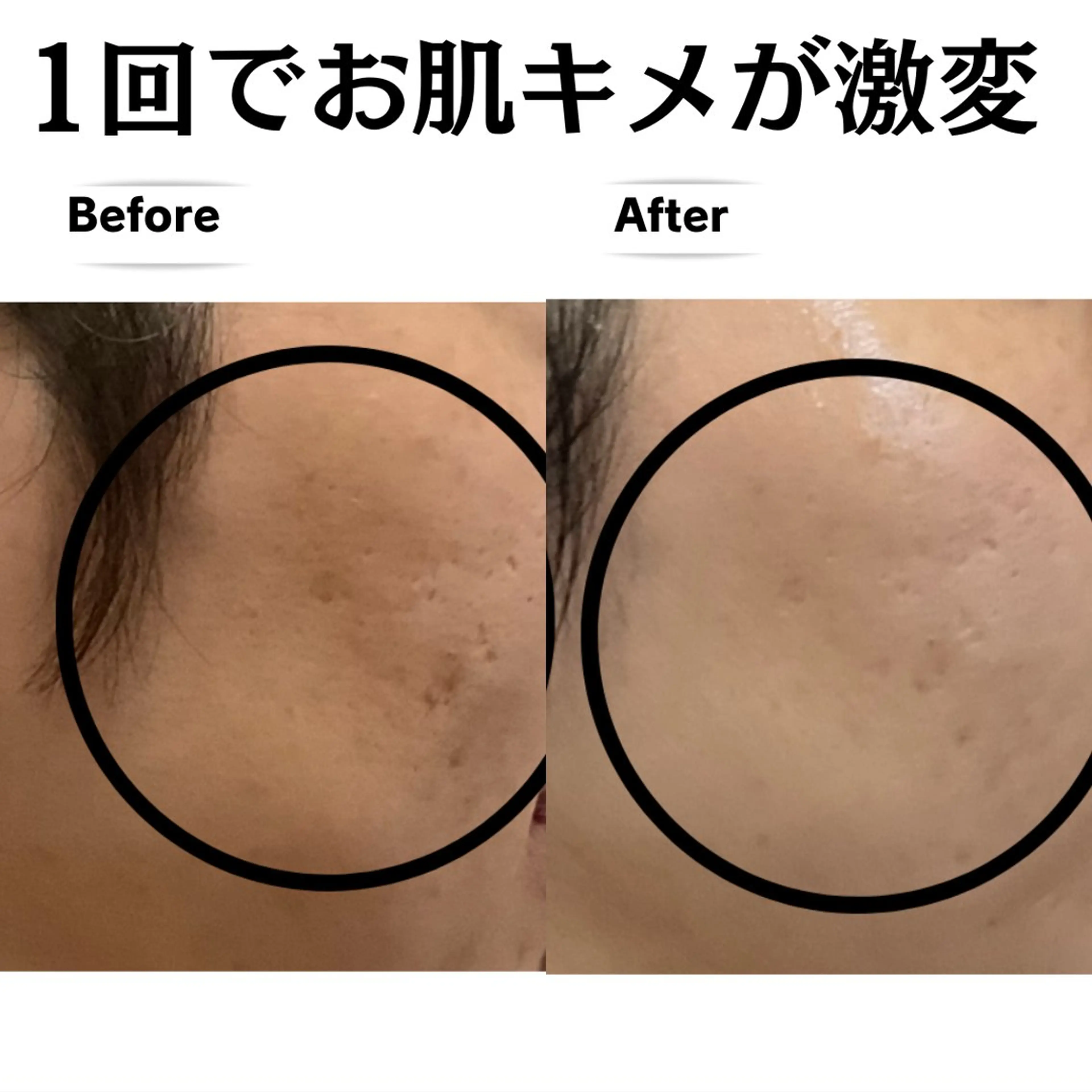 フェイシャルエステサロン 　グレースティー所属・毛穴・ニキビ専門 エステグレースティーのエステ・リラクイメージ