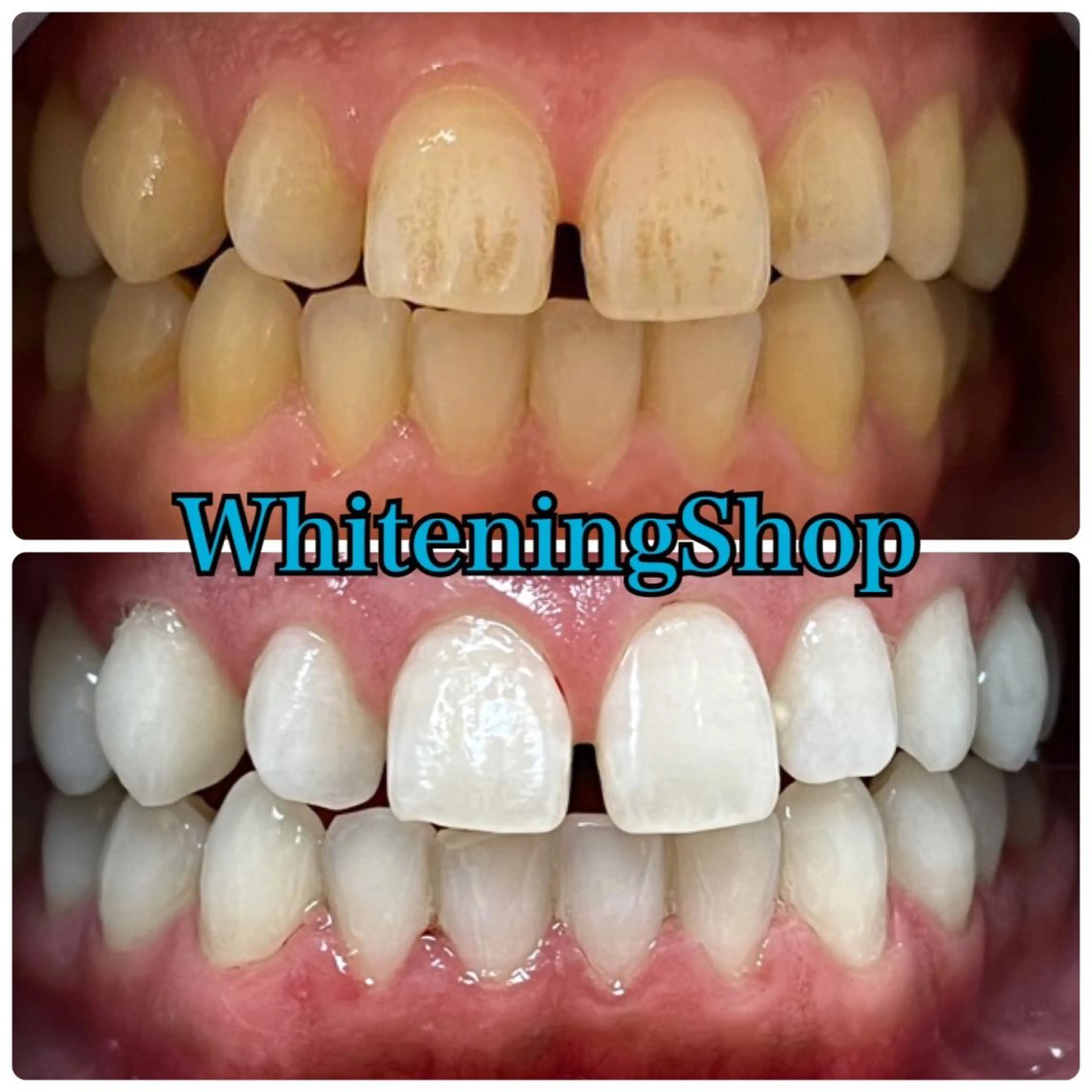 ホワイトニング ショップ吉祥寺店のエステ・リラクイメージ