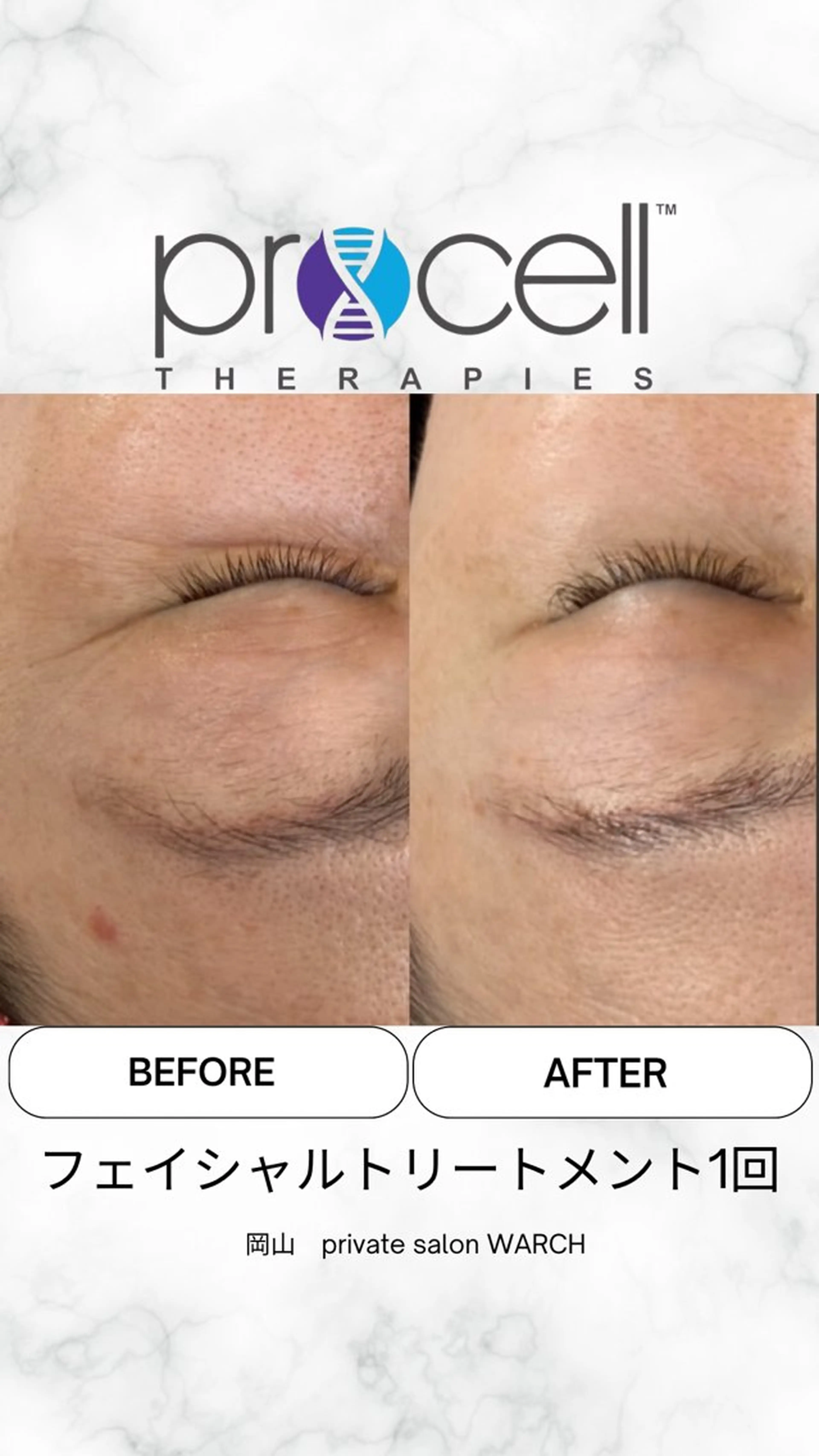 WARCH Marieのその他イメージ