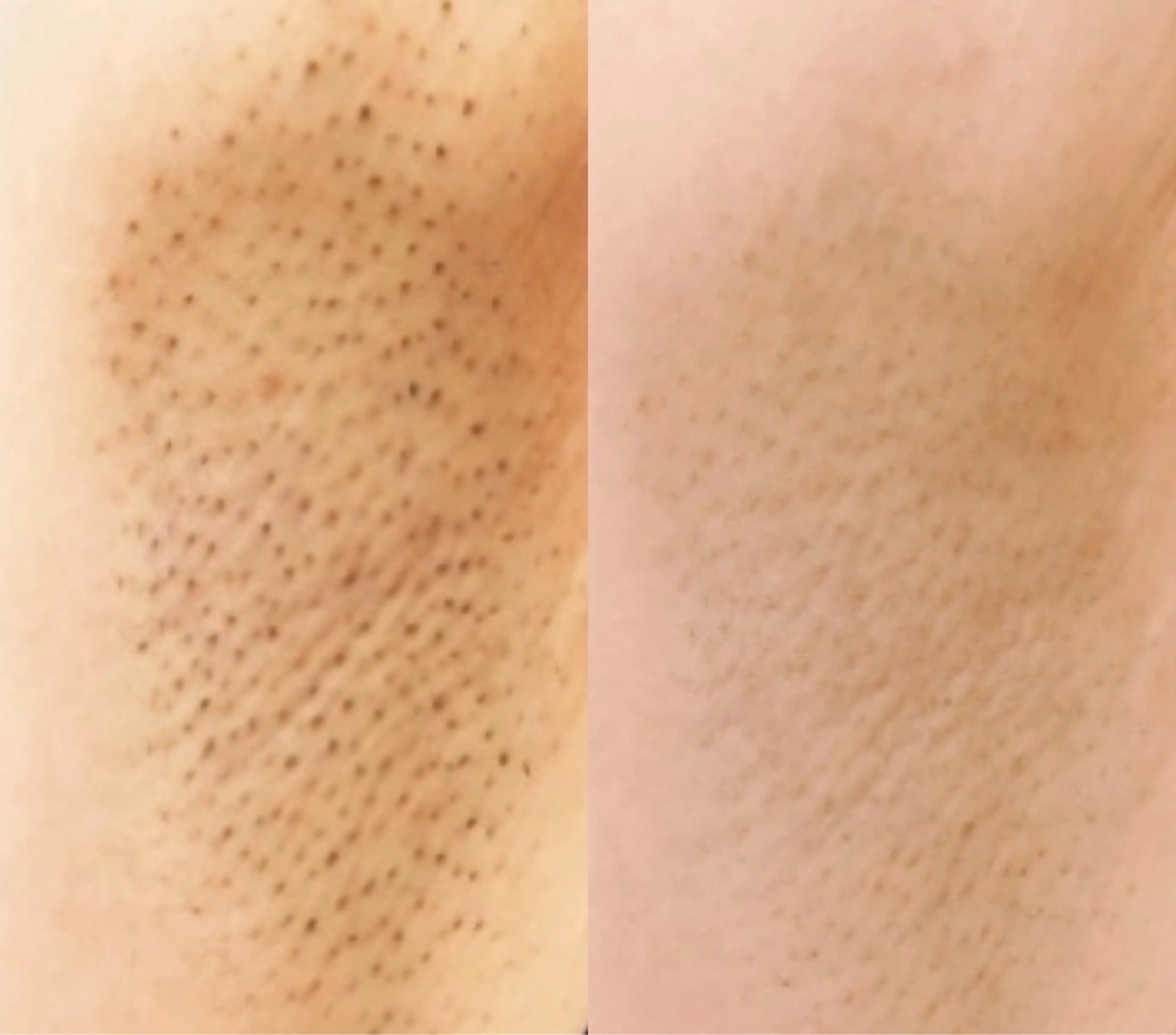 スターラッシュ薬院本店所属・スターラッシュ staffのエステ・リラクイメージ