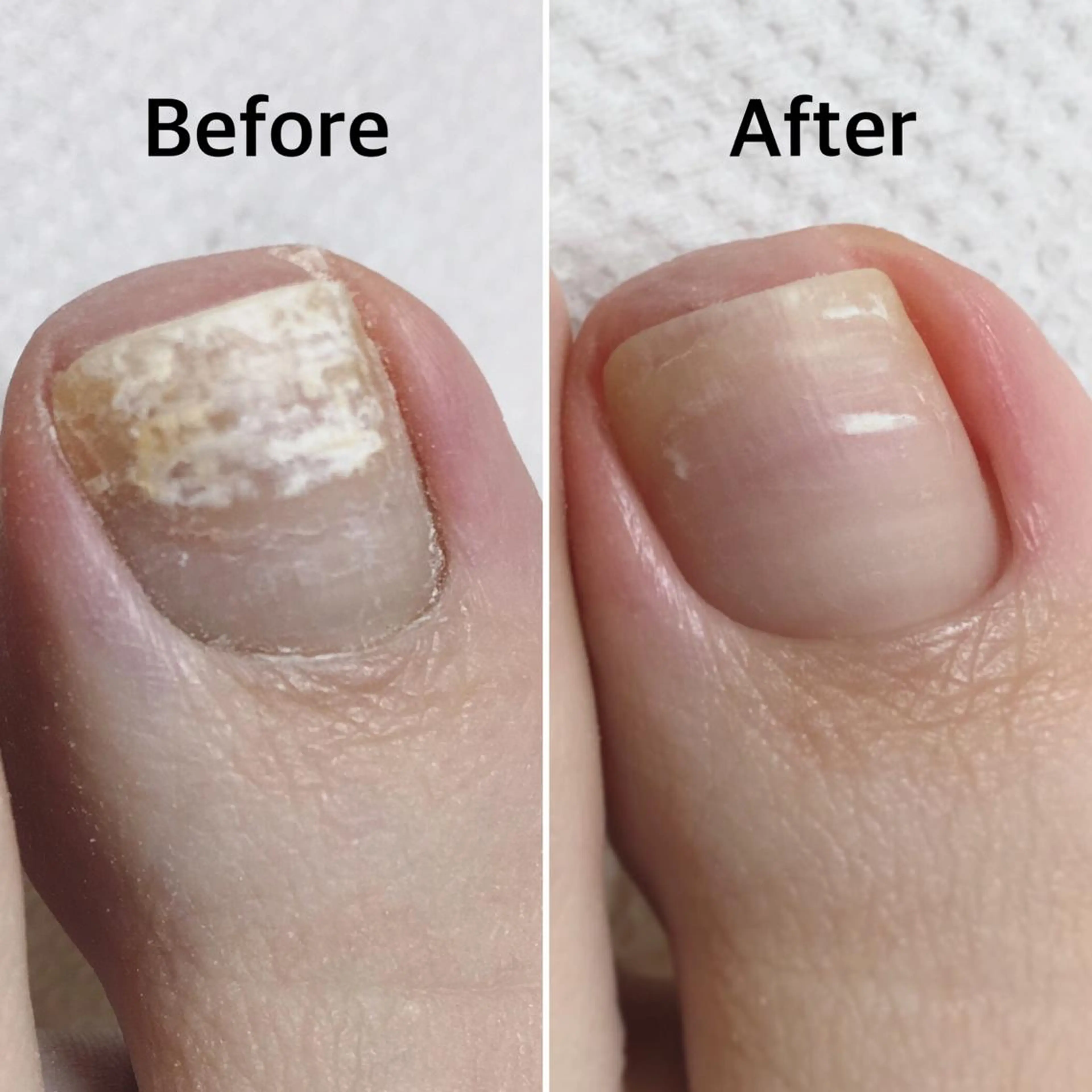 フット*極上ジェルワンカラー👣爪周りのすっきり甘皮角質ケア付✨オフ込みの場合¥6800👣の写真