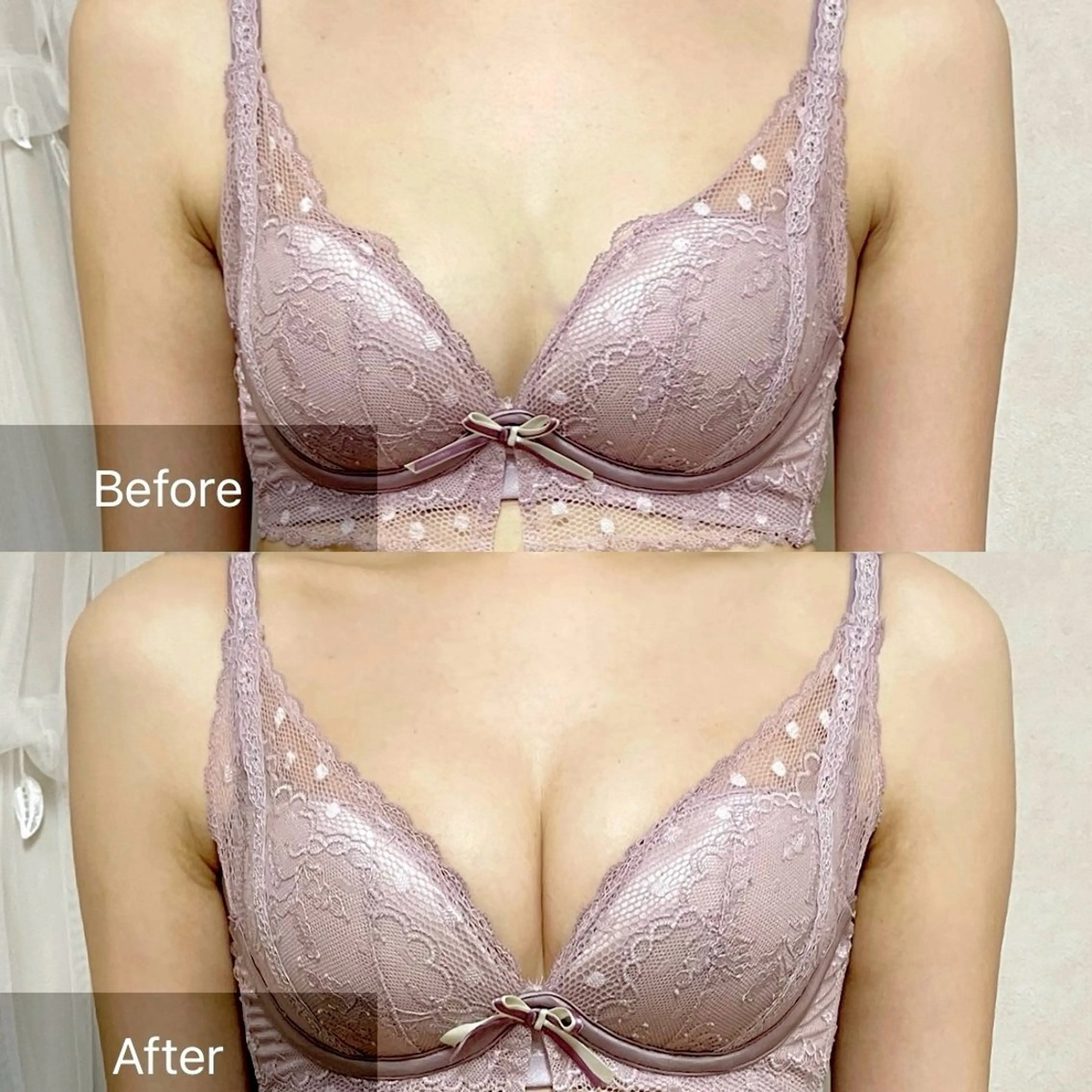 写真モニター価格【下垂/離れ乳改善】上半身＆バストマッサージ＋美乳マシーン初回体験の写真