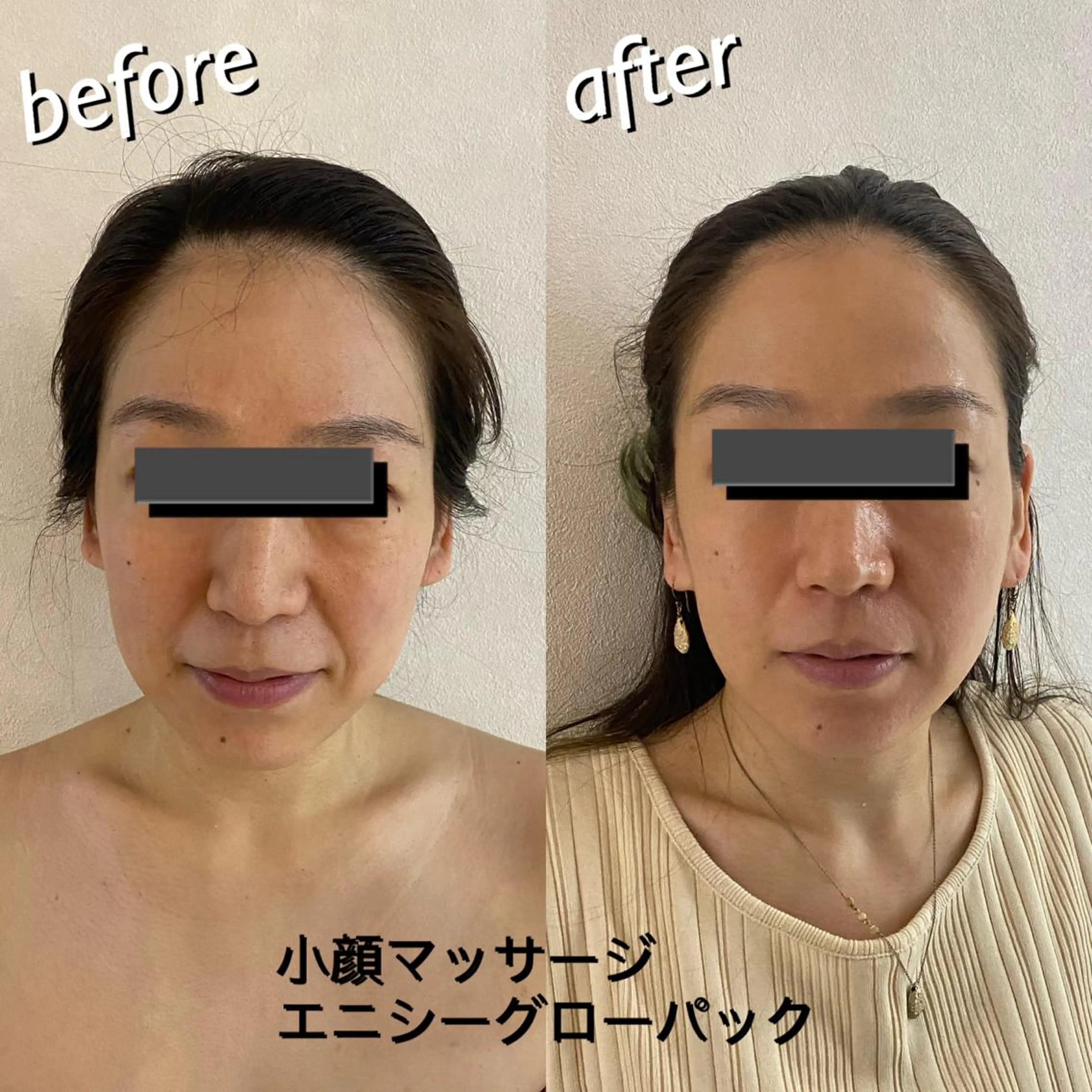 うなじ脱毛/美肌脱毛 LABELのエステ・リラクイメージ