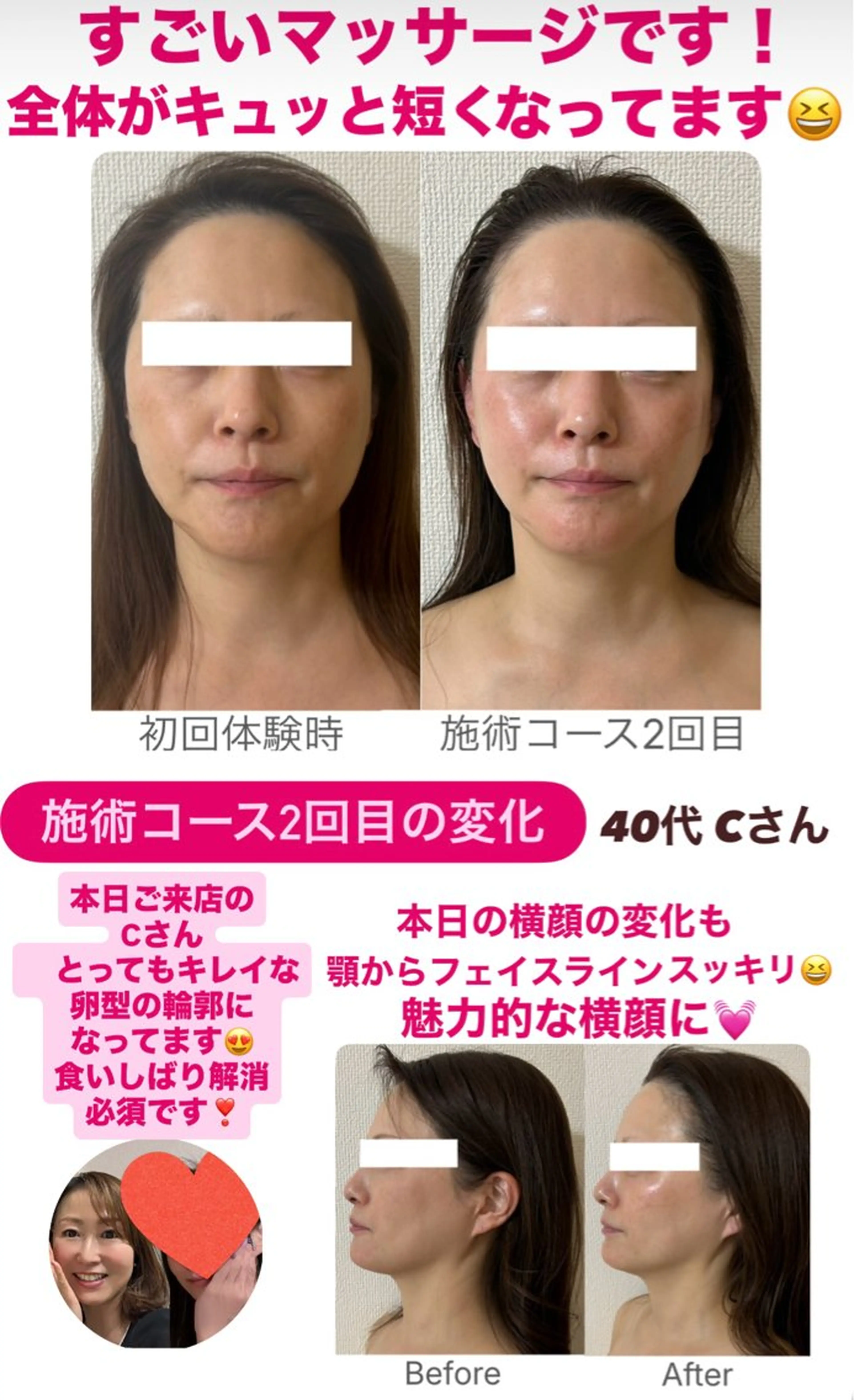 la lumie're (ラ リュミエール)所属・小顔サロン (ラ リュミエール)のエステ・リラクイメージ