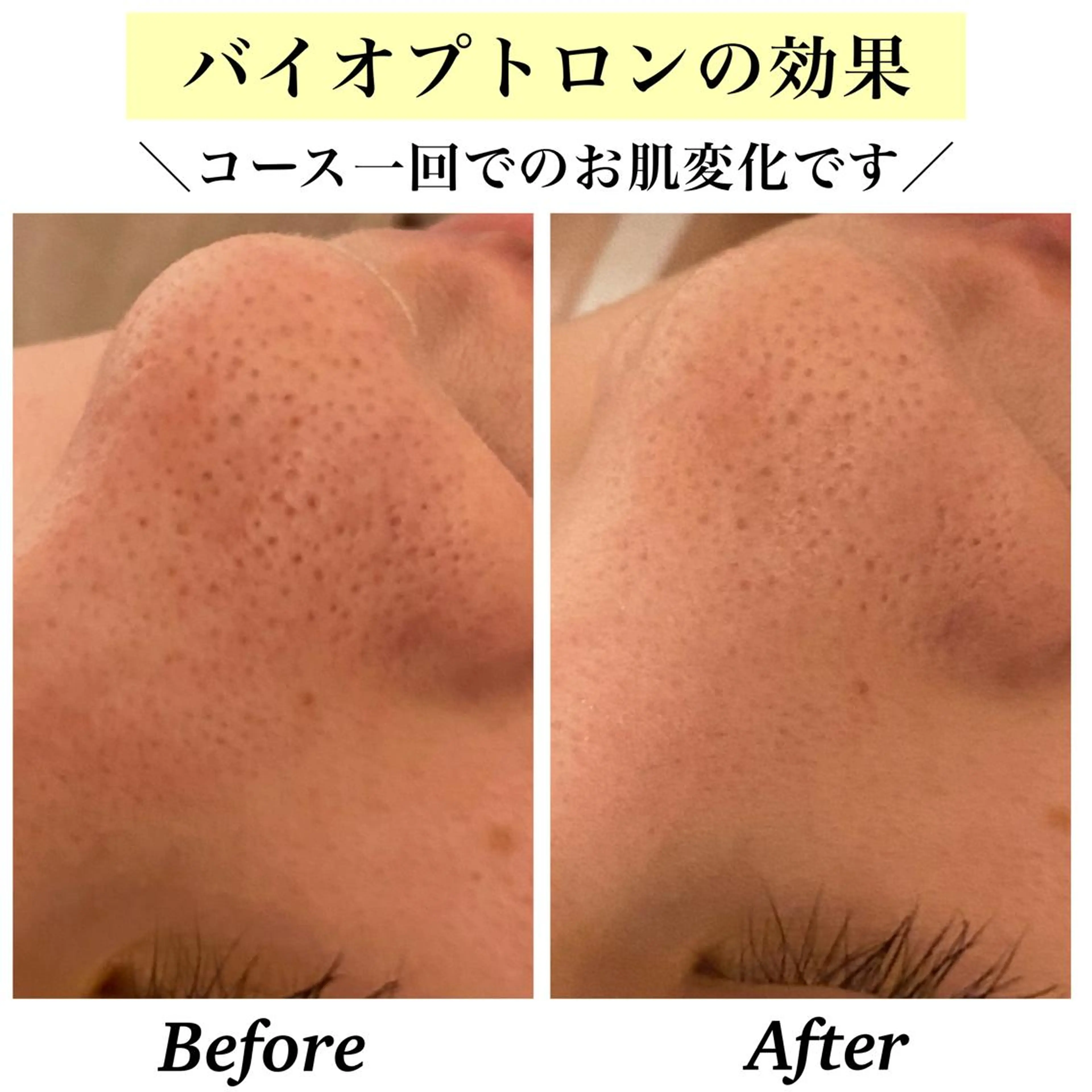 エステ リラク Bellesthe （ベルエステ）のエステ・リラクイメージ