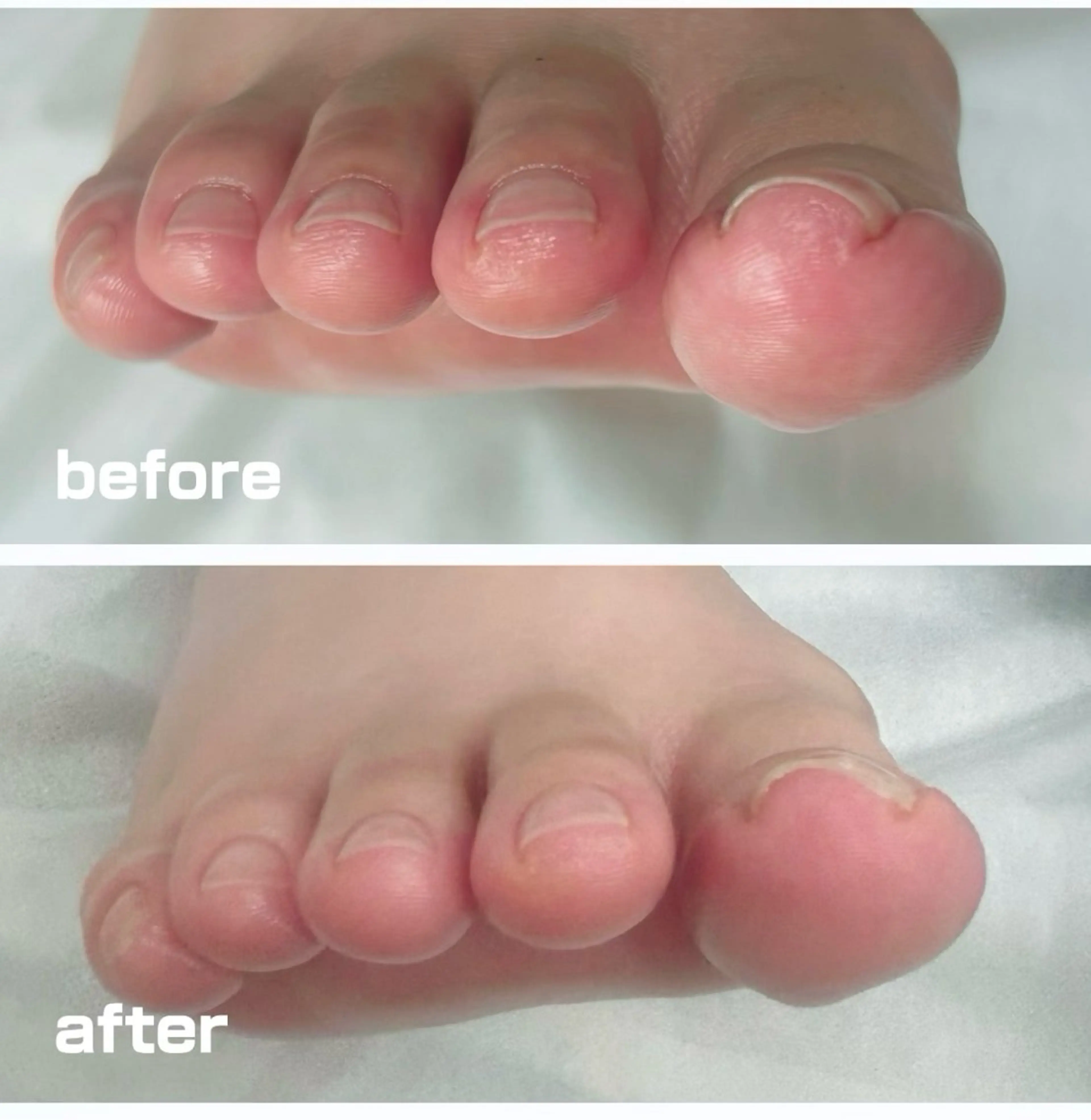 その他 巻き爪フットケアサロンKotori所属・フットケアサロン Kotoriのその他イメージ
