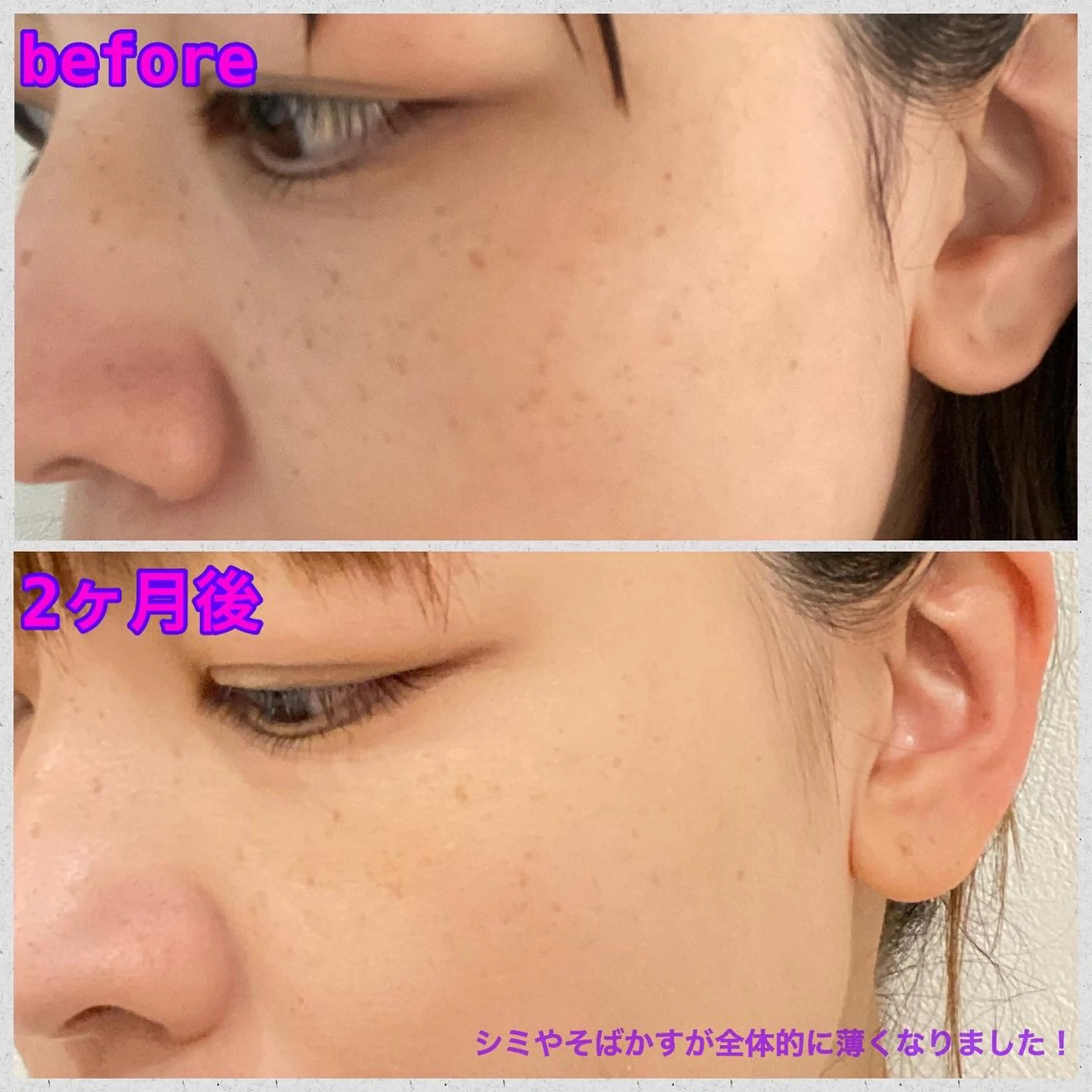 aimer beautyのエステ・リラクイメージ