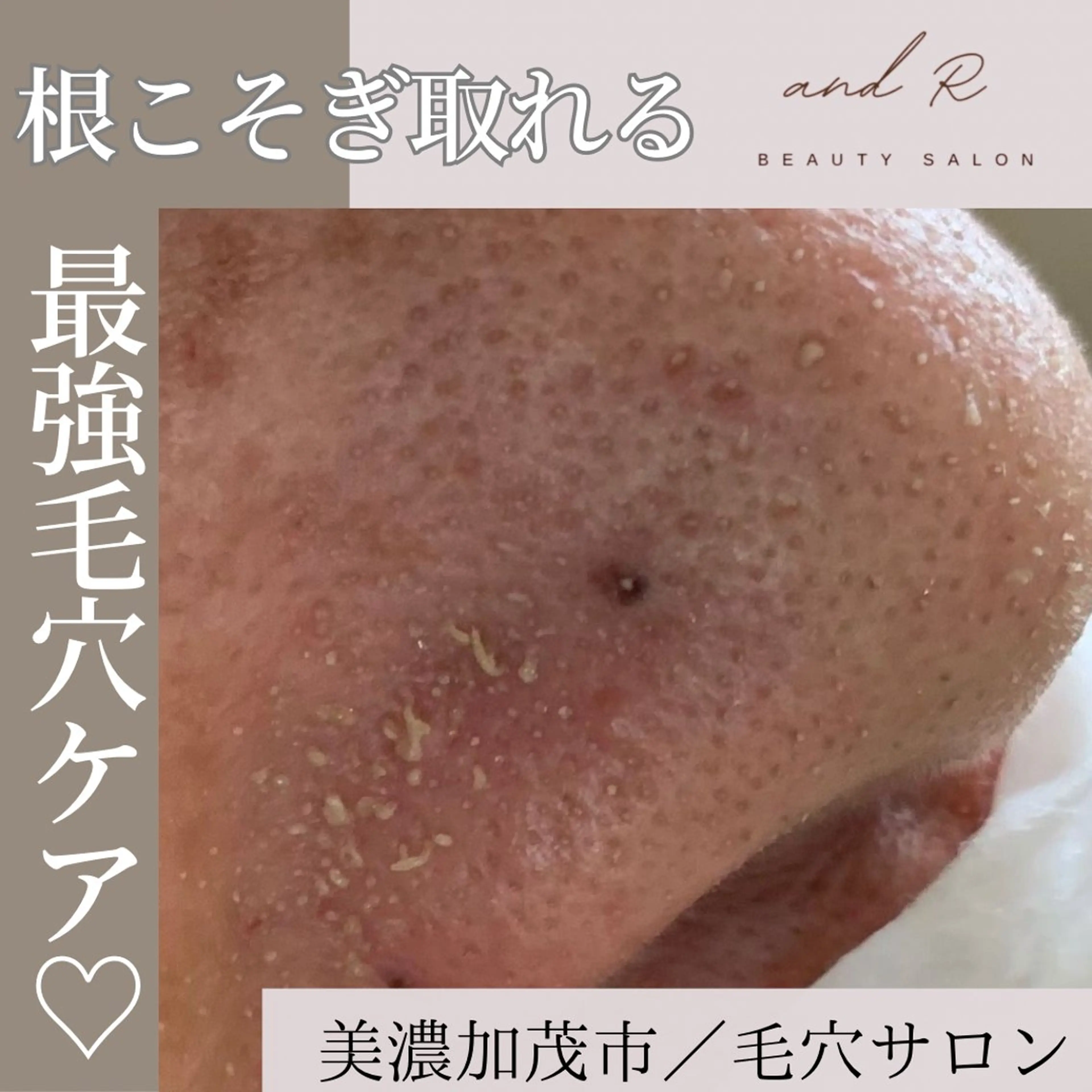 and R 男女 脱毛、毛穴サロンのエステ・リラクイメージ