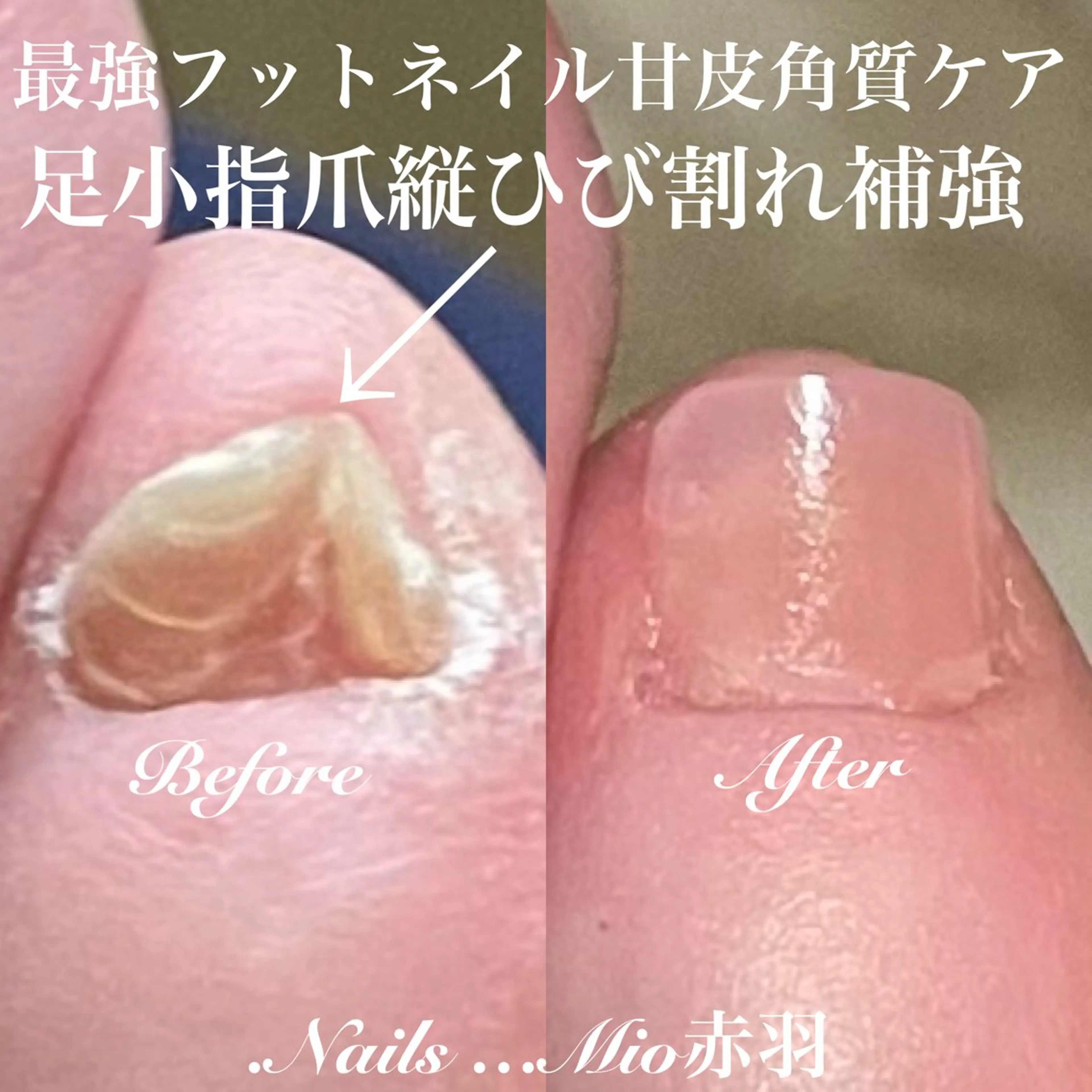 ネイル フットネイル 赤色 フットネイル .Nails Mio 赤羽西ネイルサロンのネイルデザイン