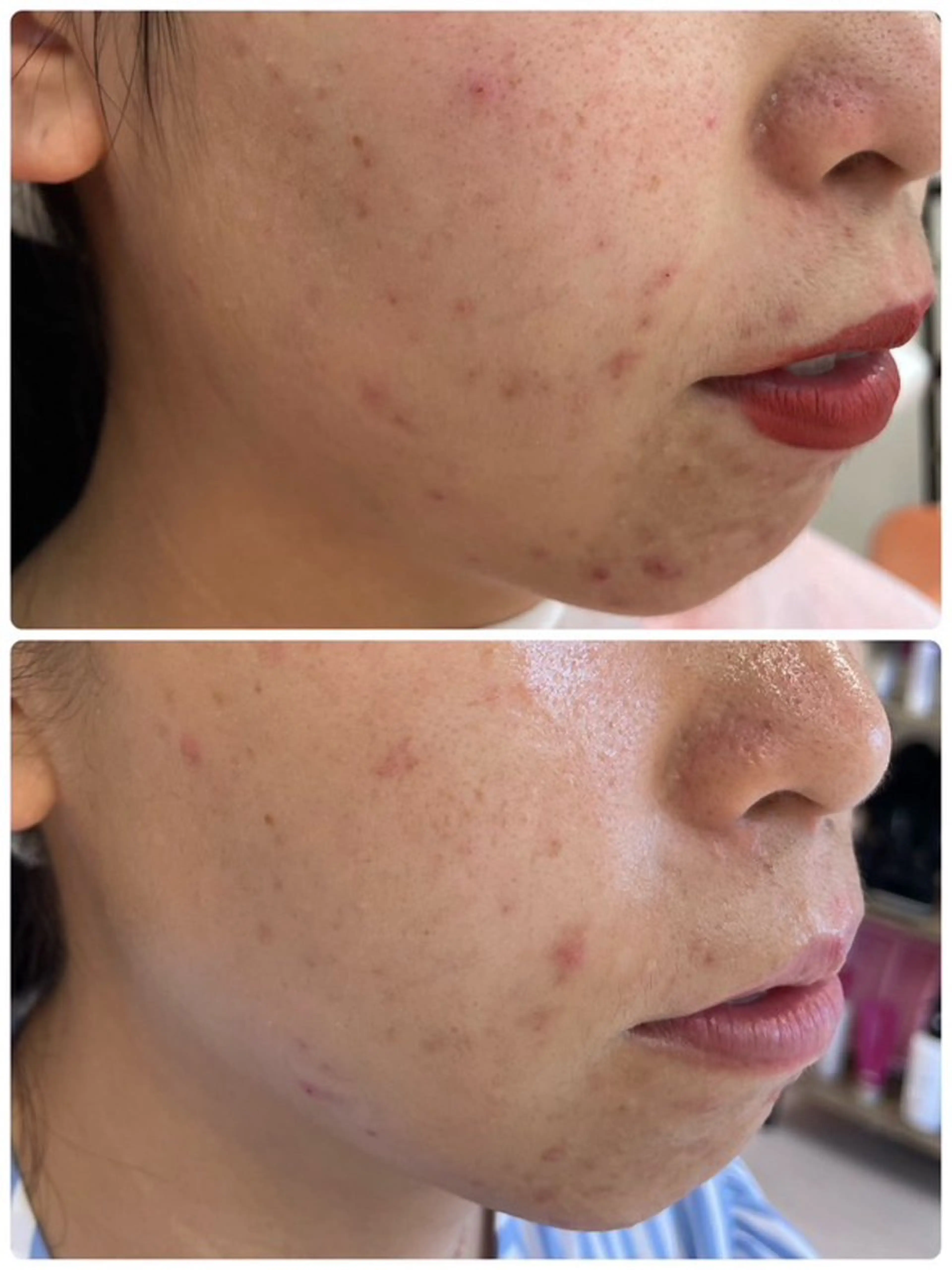 ありな/巡りを整える肌質改善サロン所属・ありな 肌質改善サロンのエステ・リラクイメージ