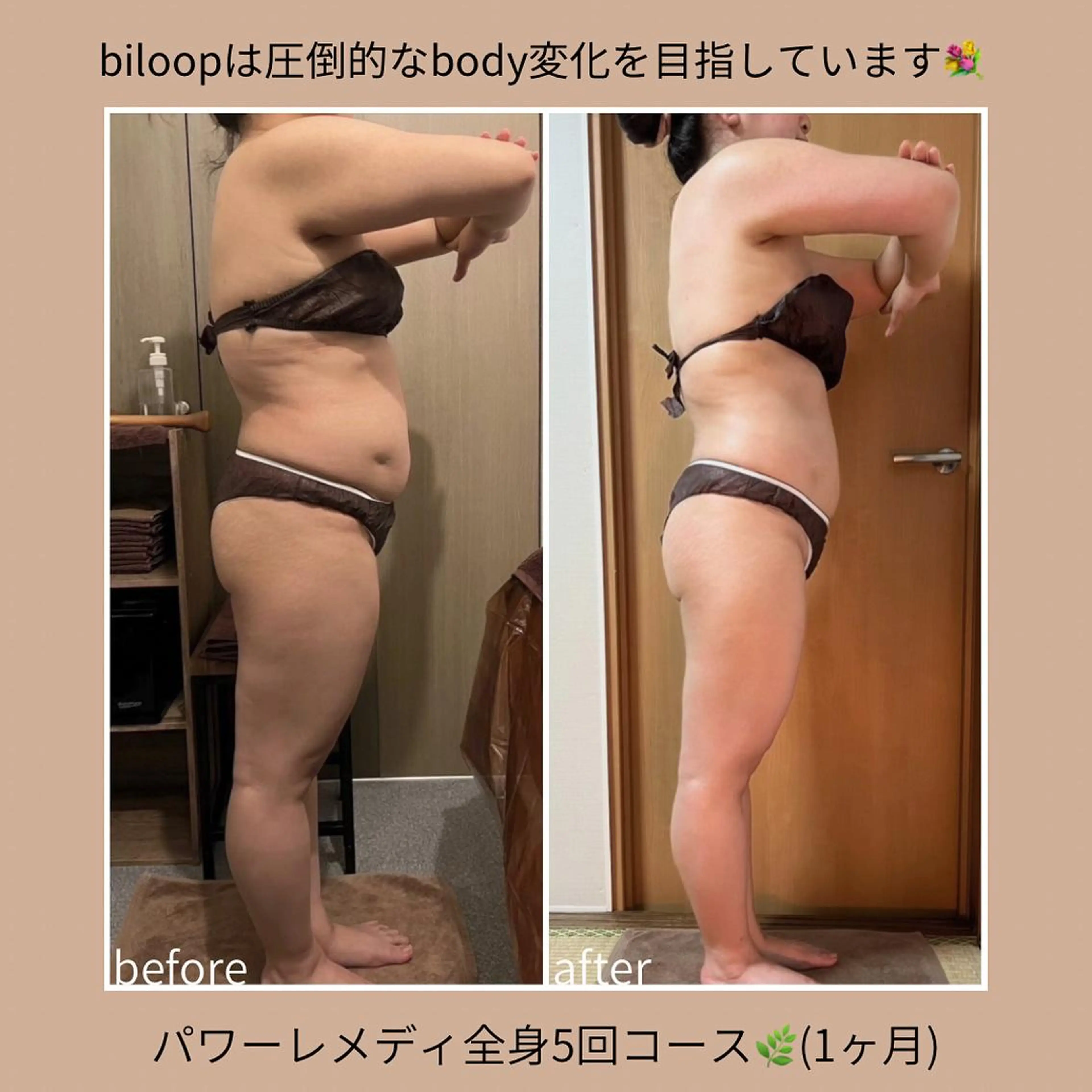 biloop所属・《本気痩せ×疲労改善 》  BILOOPのエステ・リラクイメージ