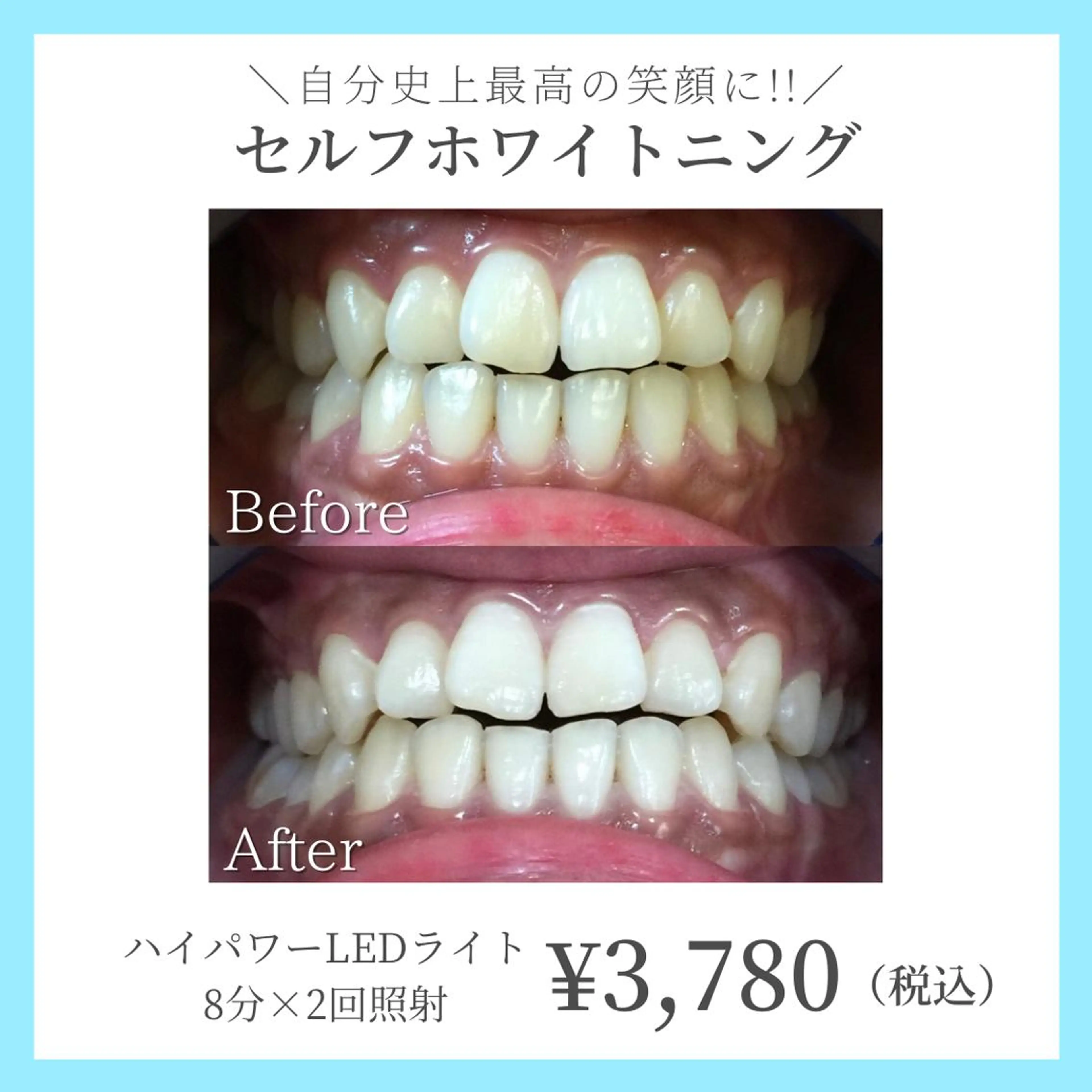 コガオファクトリー 北24条店のエステ・リラクイメージ