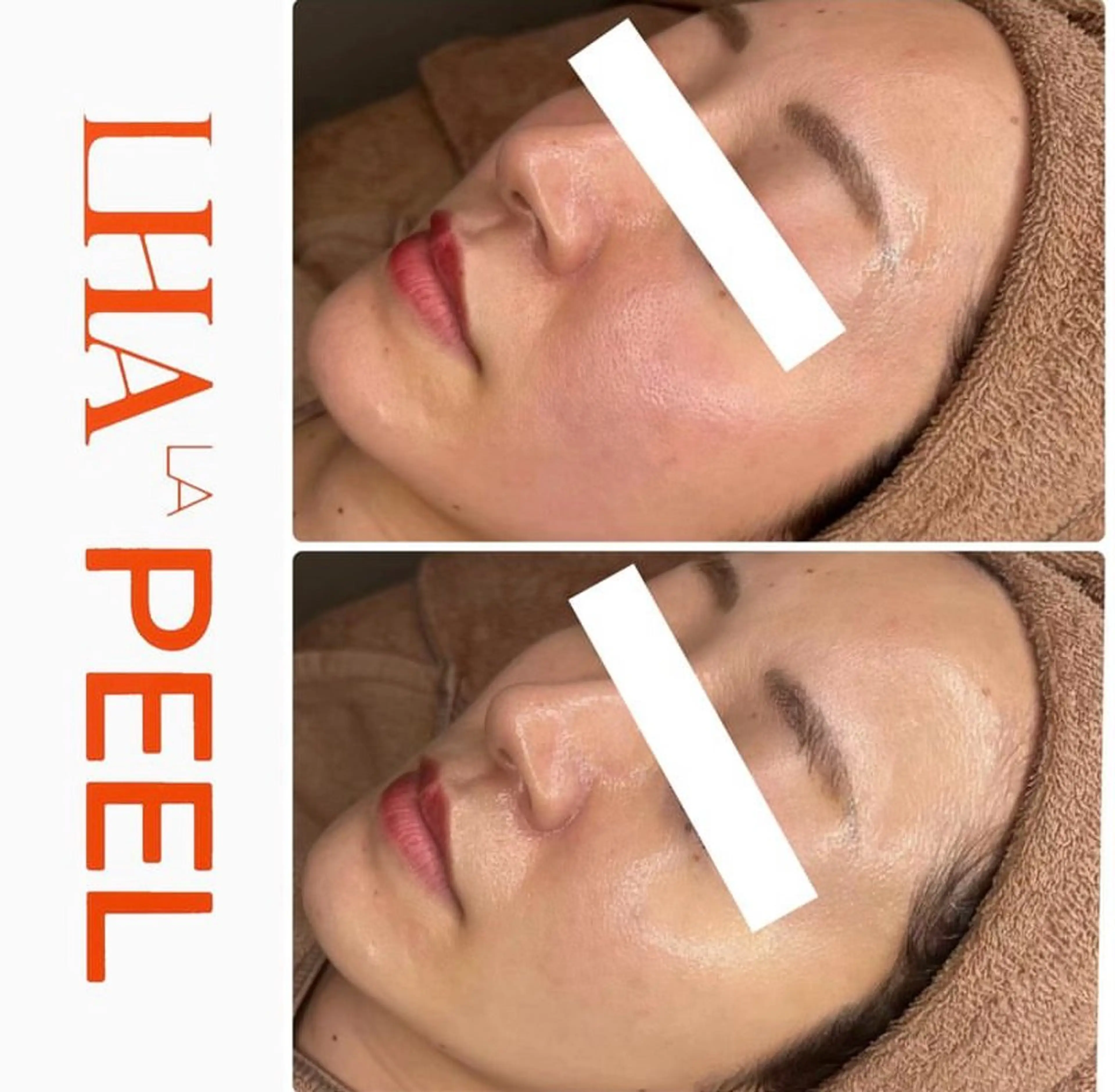 エステ ハーブピーリング専門 BIOPLUS＋川崎のエステ・リラクイメージ