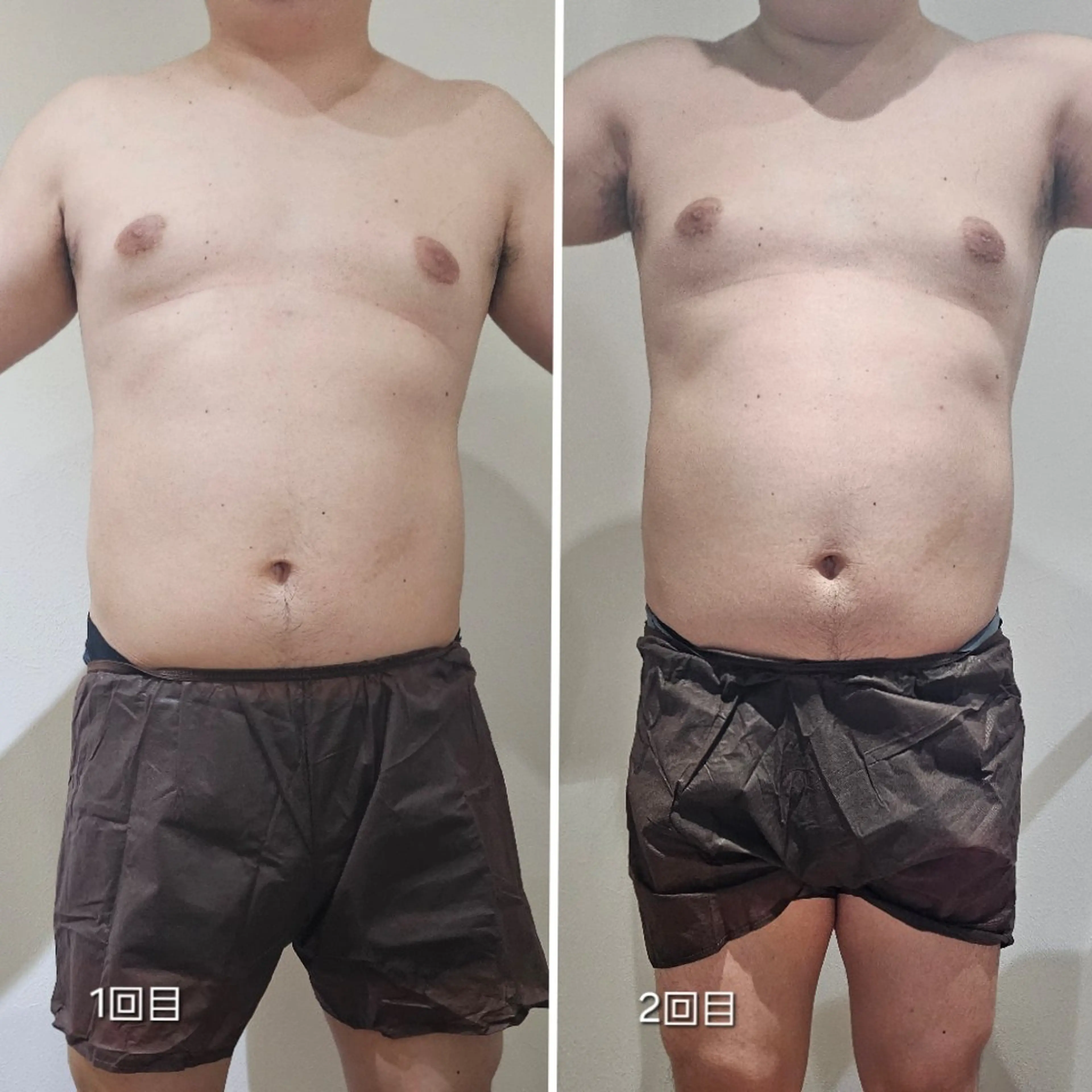 エステ 脂肪冷却 & 脱毛 AYUMIのその他イメージ