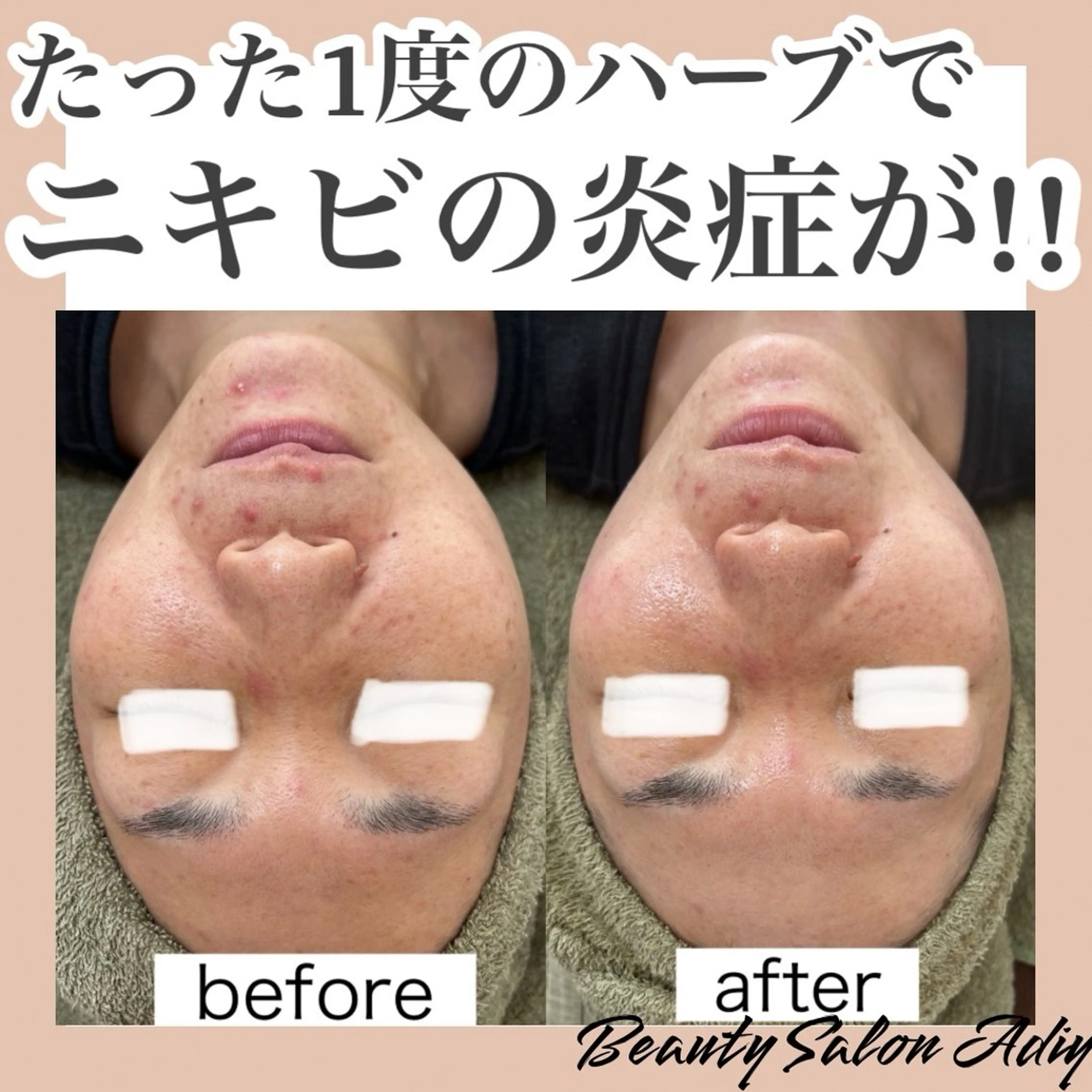 Beauty   Salon  Adiy所属・Adiy ikumiのエステ・リラクイメージ
