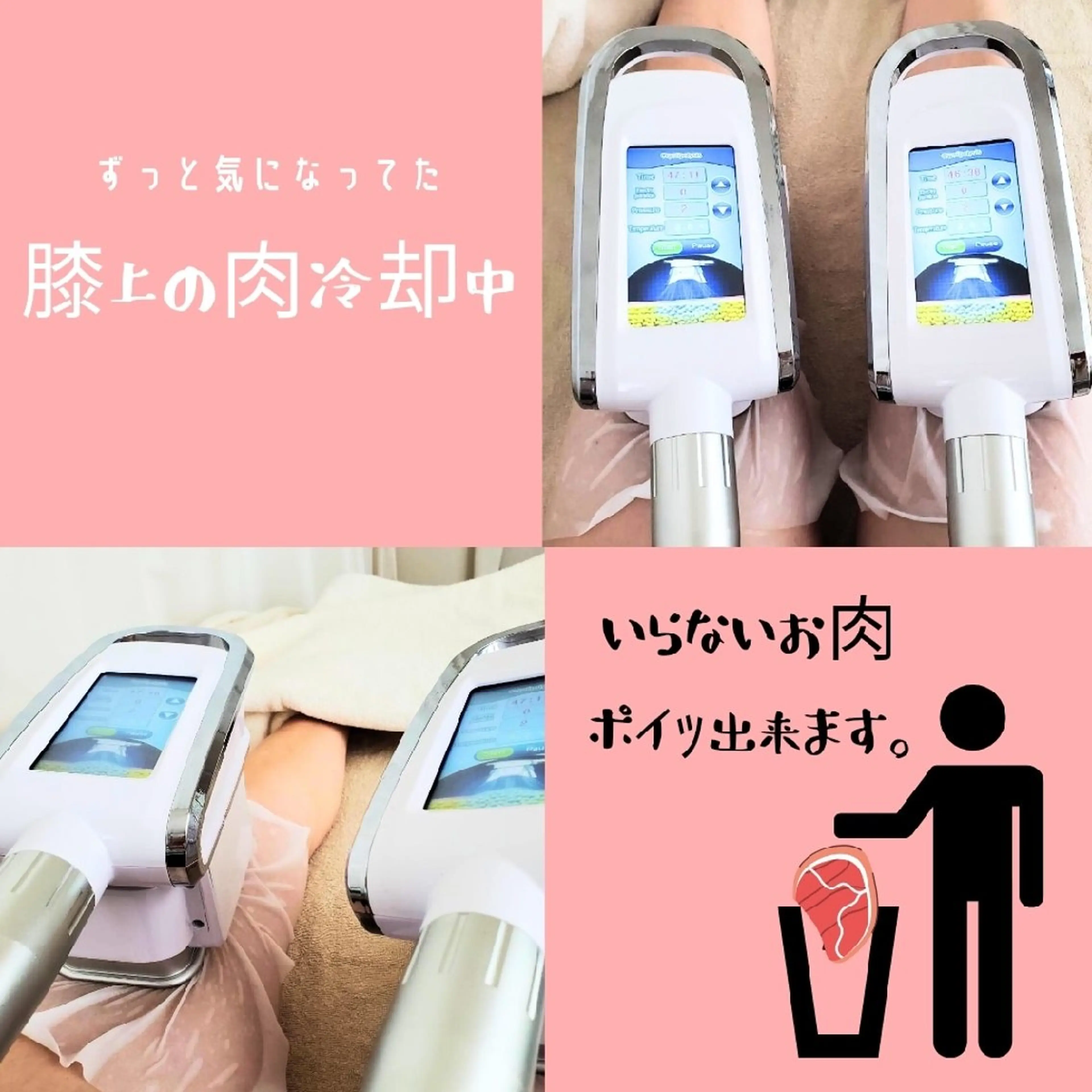 脂肪冷却・脱毛・フェイシャルサロンcoconoix [ｺｺﾉﾜ]所属・脂肪冷却・脱毛サロン coconoix のエステ・リラクイメージ