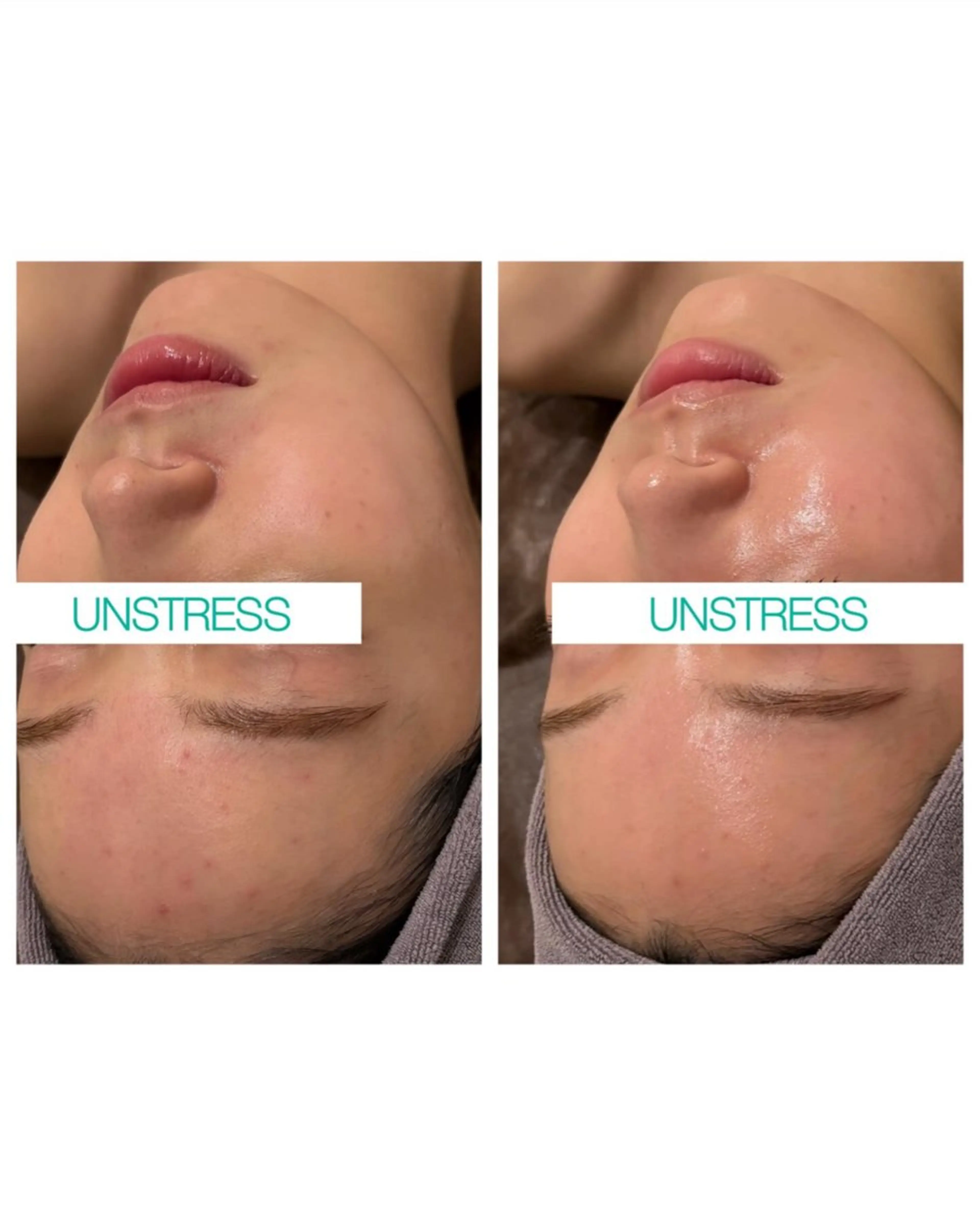 エステ リラク ☆痩身/小顔☆ 結果出します☆のエステ・リラクイメージ