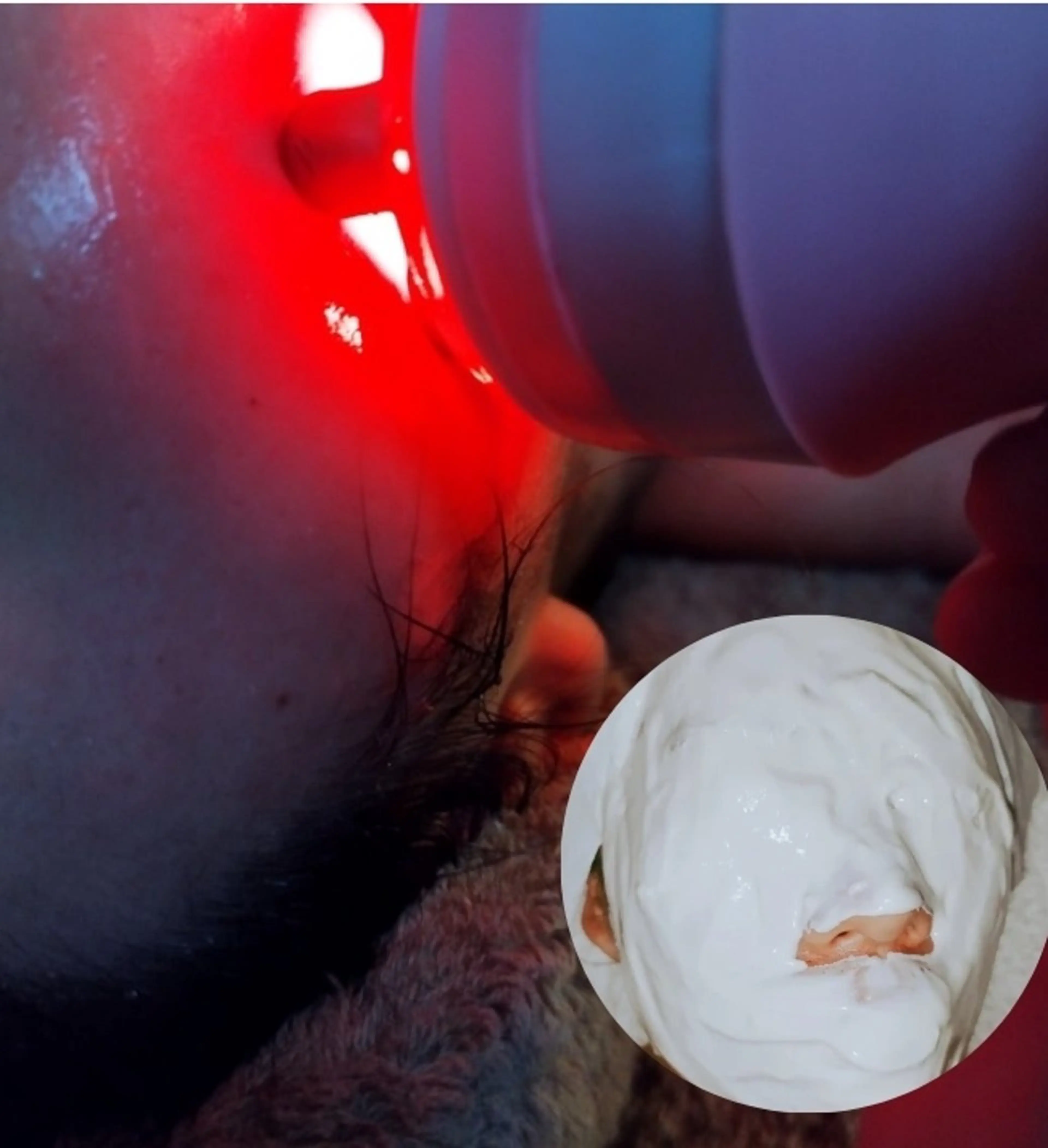 ラジオ波照射/ 小顔・引き締めフェイシャルコース /50分の写真