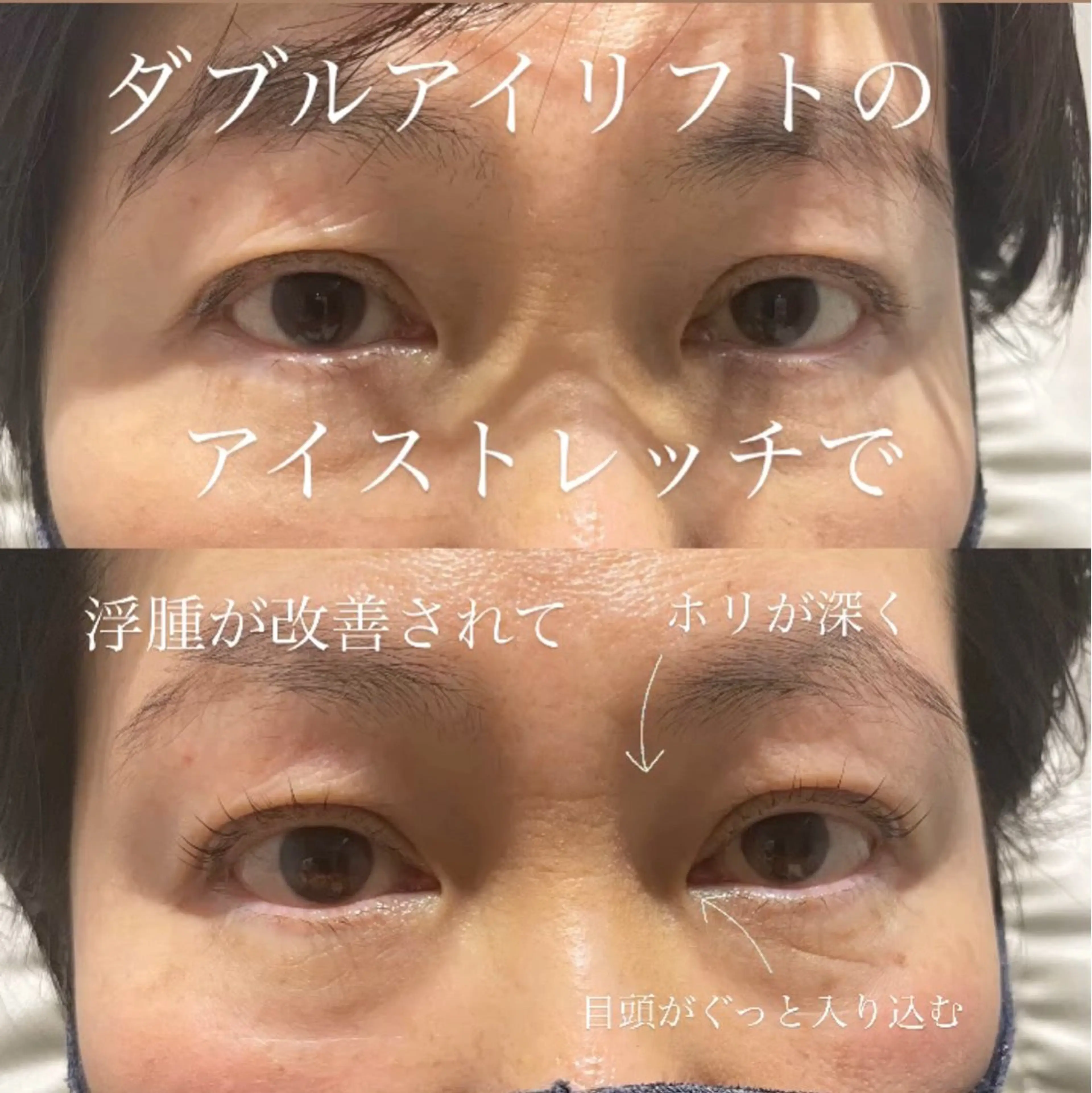 マツエク・マツパ マツパ プライベートサロン Be&【ビアンド】のマツエク・マツパデザイン