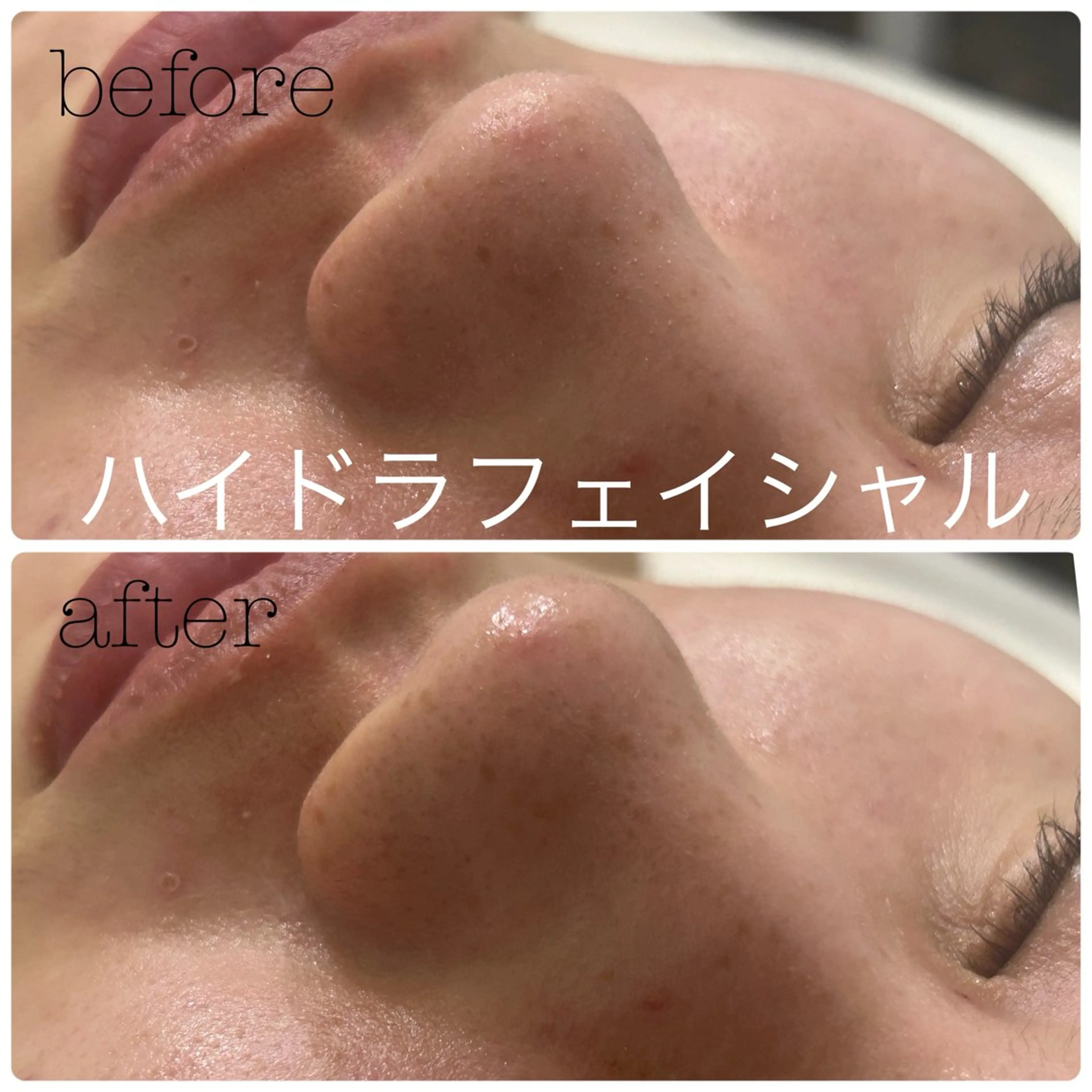 メンズ エステ フェイシャルサロン CHIARA 荒田のエステ・リラクイメージ