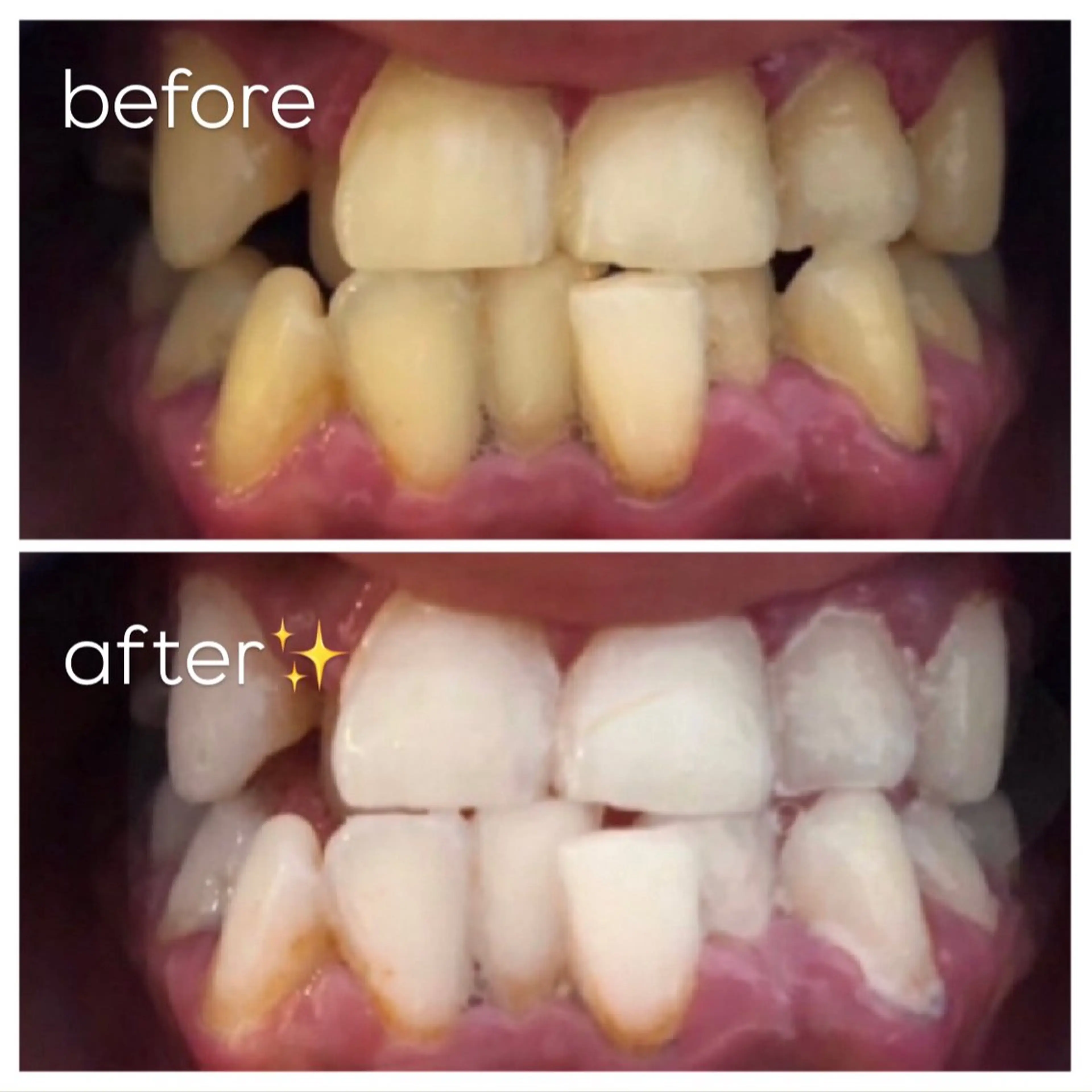 エクシア津駅前店所属・セルフホワイトニング エクシア津駅前店のその他イメージ