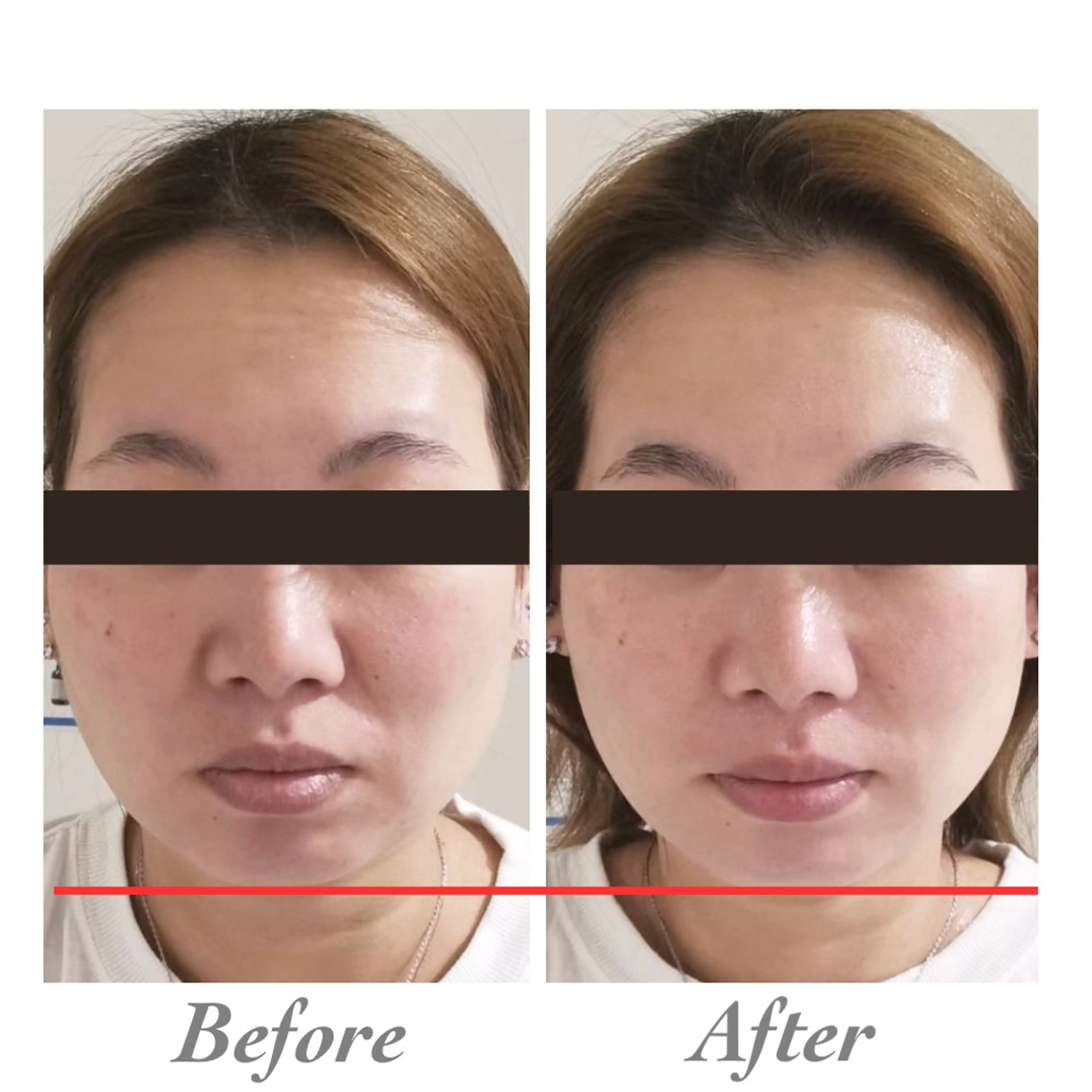 小顔・ツルツル素肌 ハリステリアのエステ・リラクイメージ