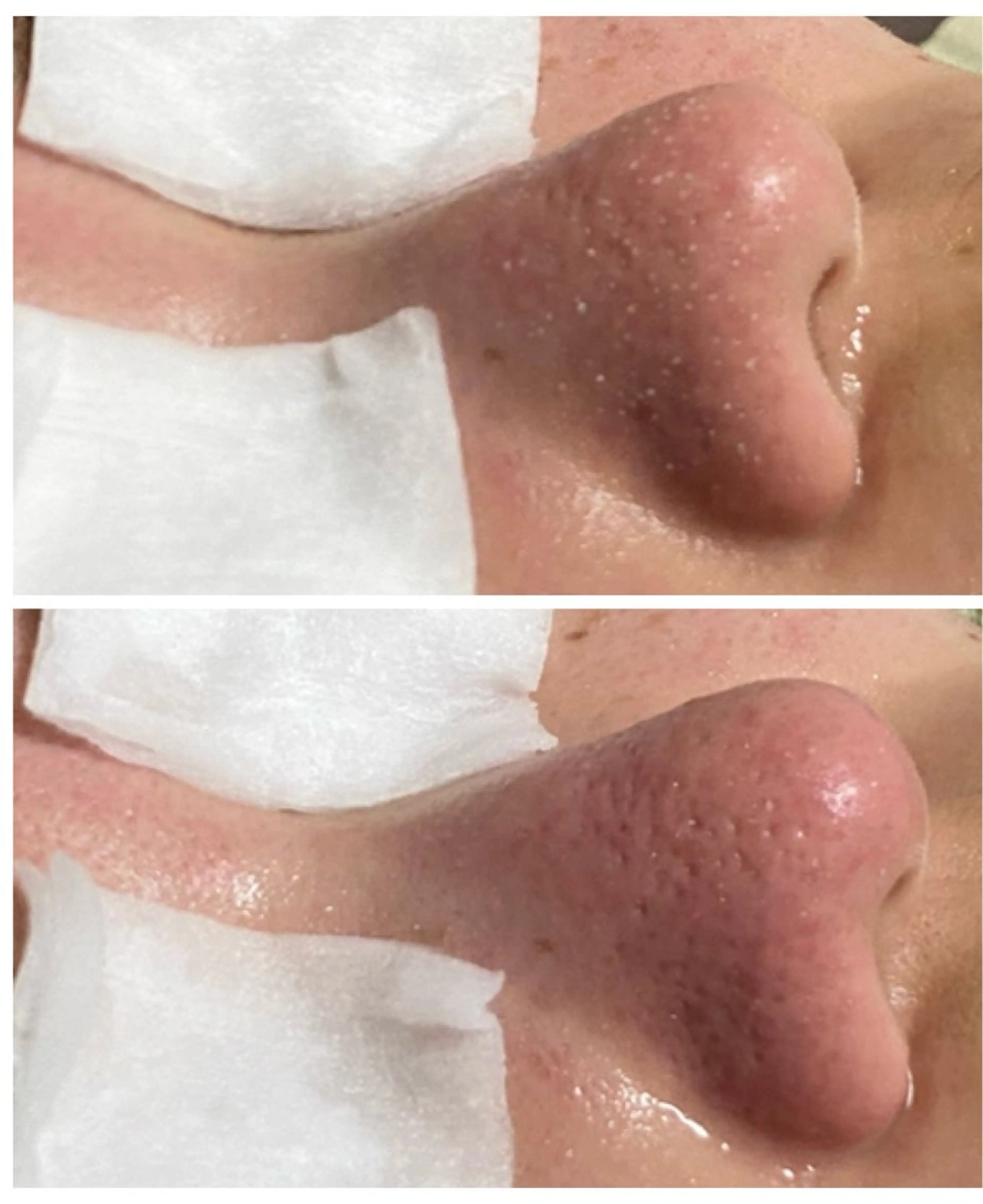 エステ Linoa所属・Linoa（リノア） エステ&リラクのエステ・リラクイメージ