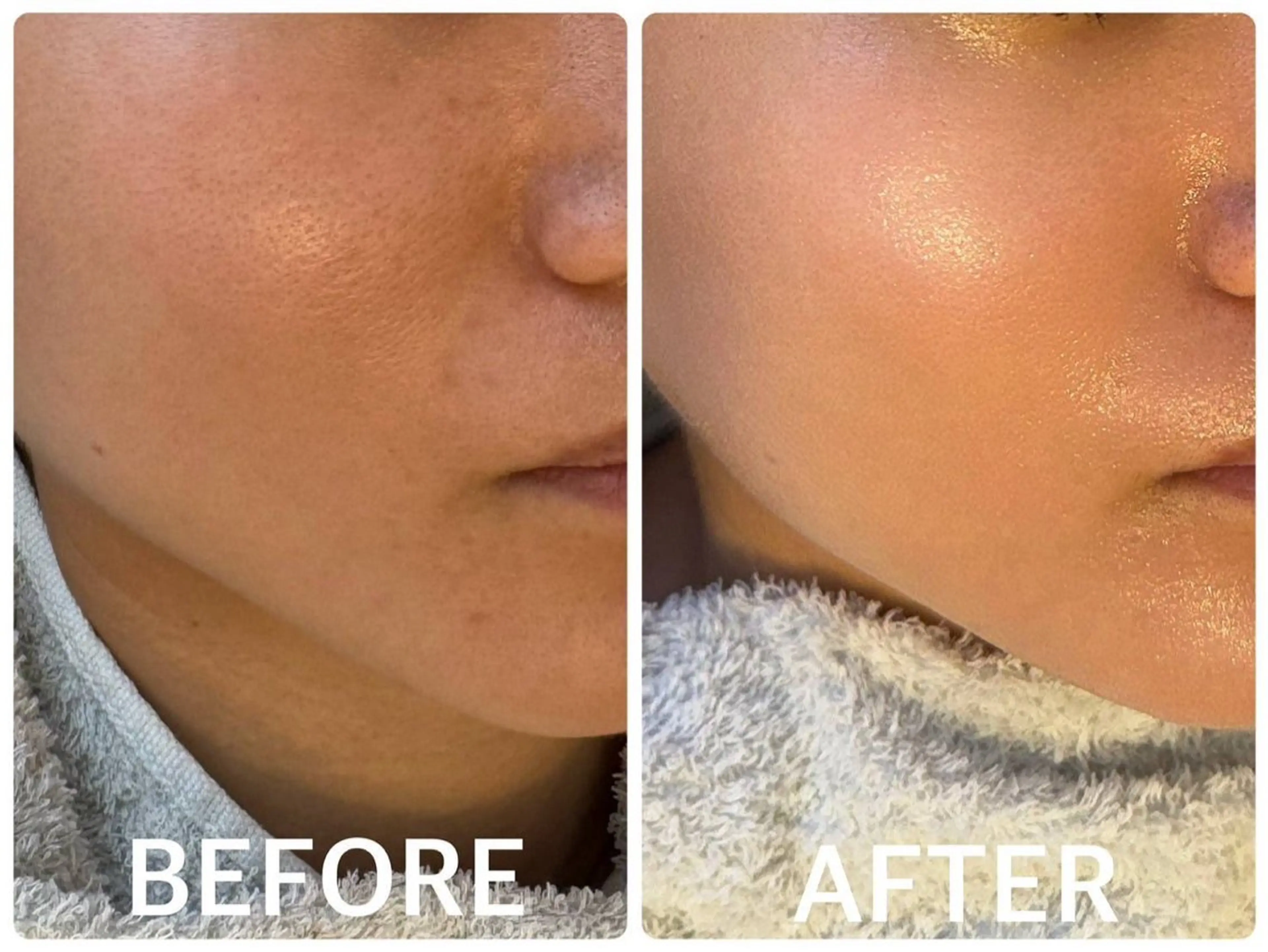 ハーブピーリング 🌿京橋のエステ・リラクイメージ