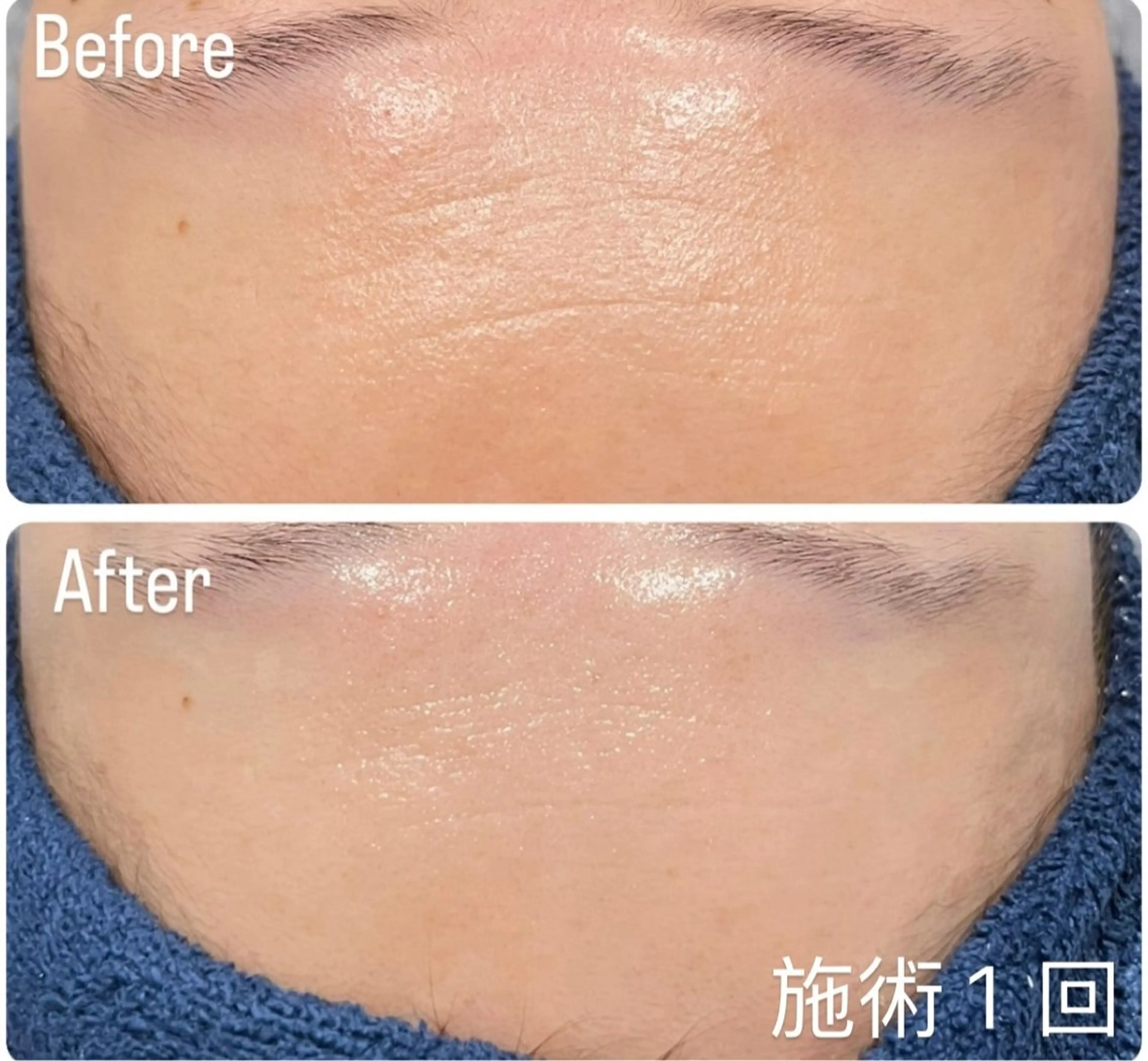 アンド ミルルのエステ・リラクイメージ