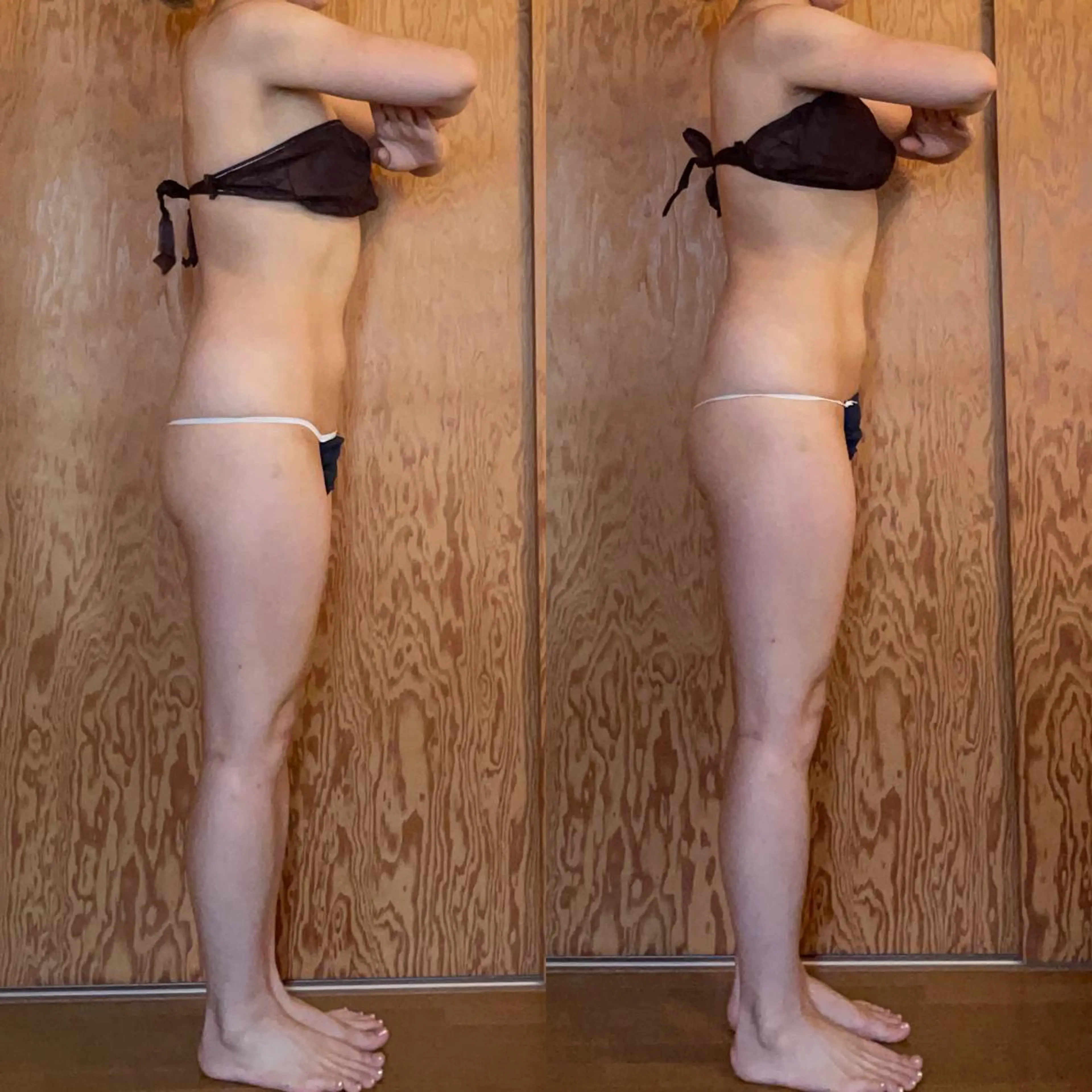 【最新ハイパワーマシーン】切らない脂肪吸引❣️お好きな箇所の写真