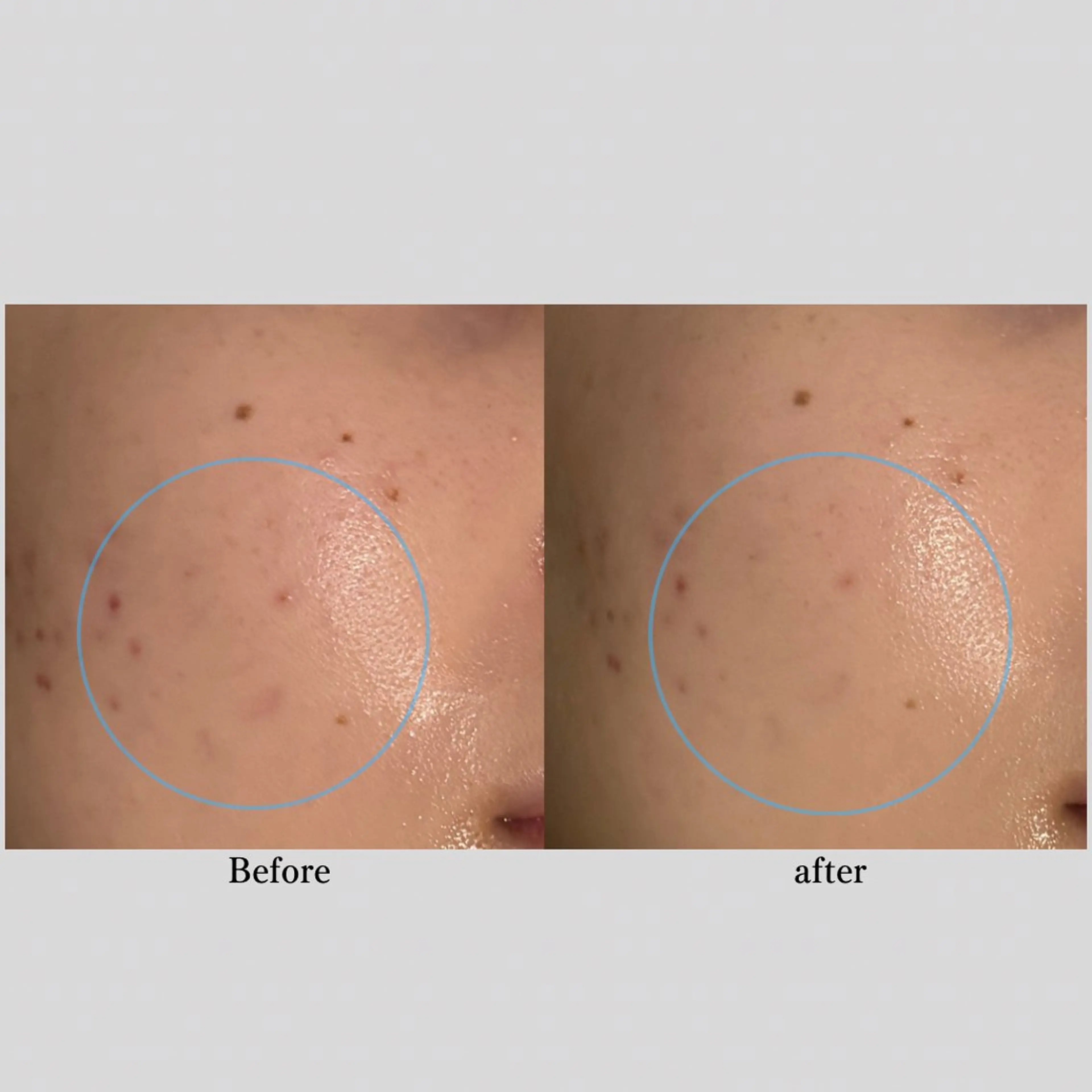 エステ 肌管理フェイシャル｜Utouto所属・肌管理フェイシャル Utoutoのエステ・リラクイメージ