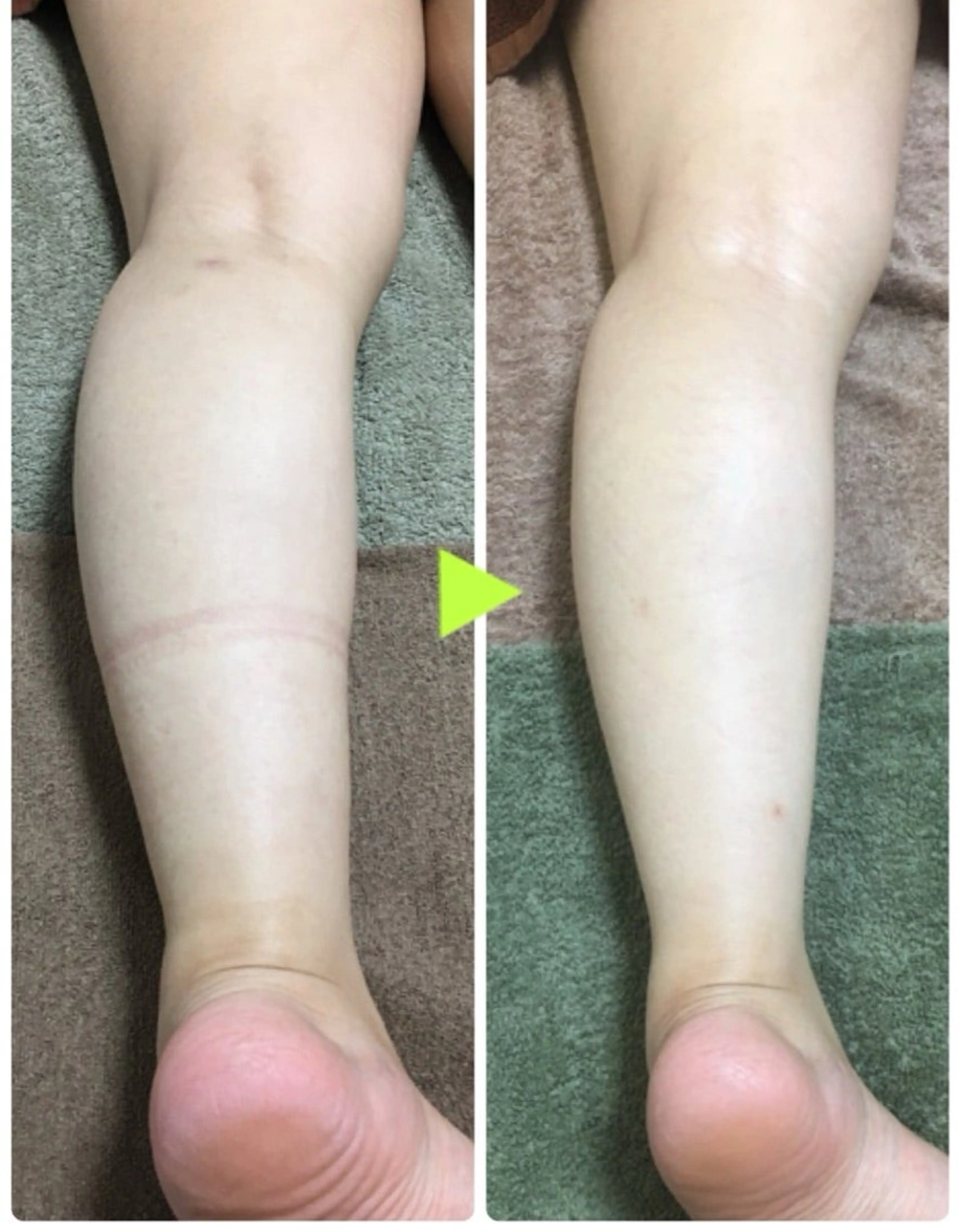 エステ 美容整体サロン ひかりのエステ・リラクイメージ