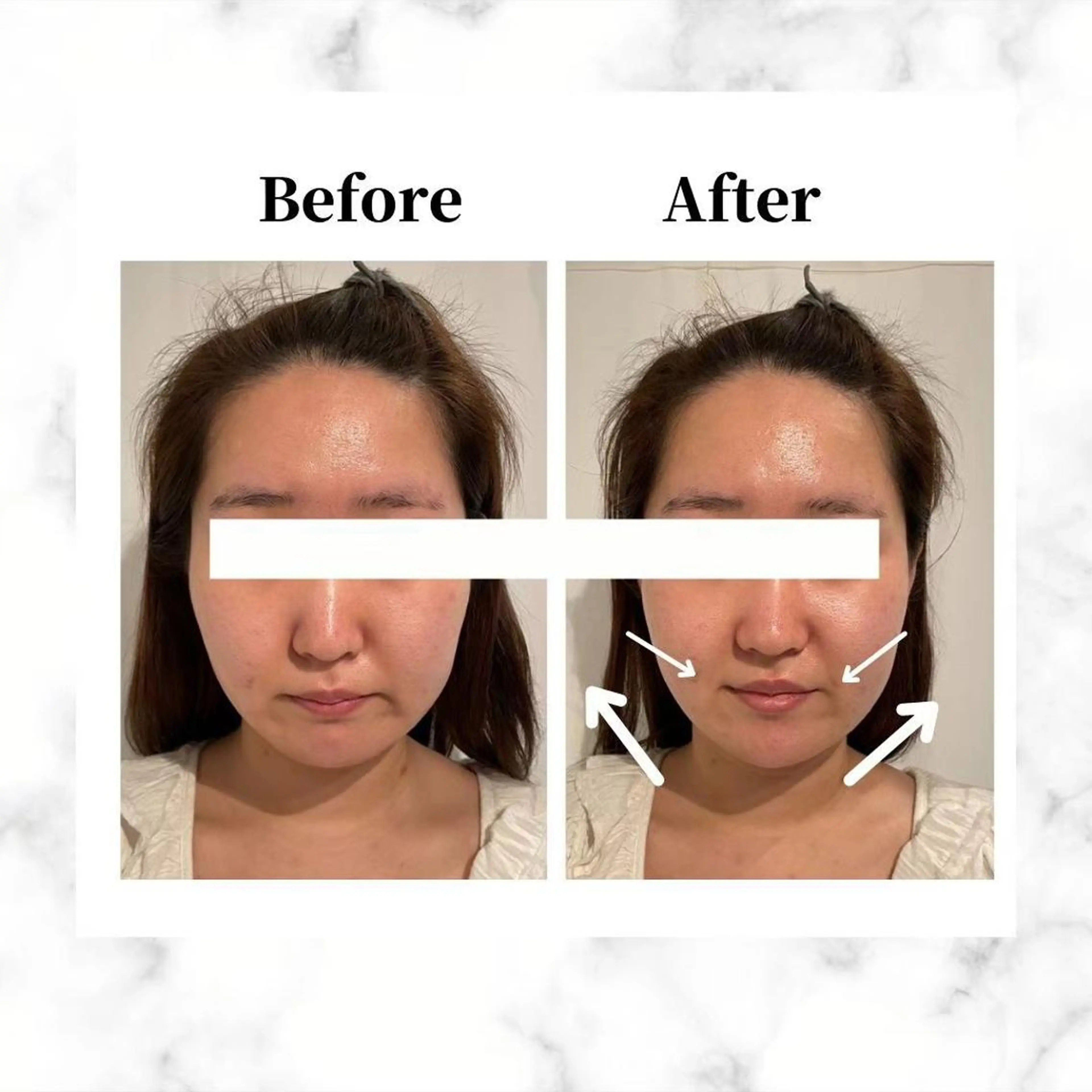 エステ リラク 12Dハイフ💗 最強小顔のエステ・リラクイメージ