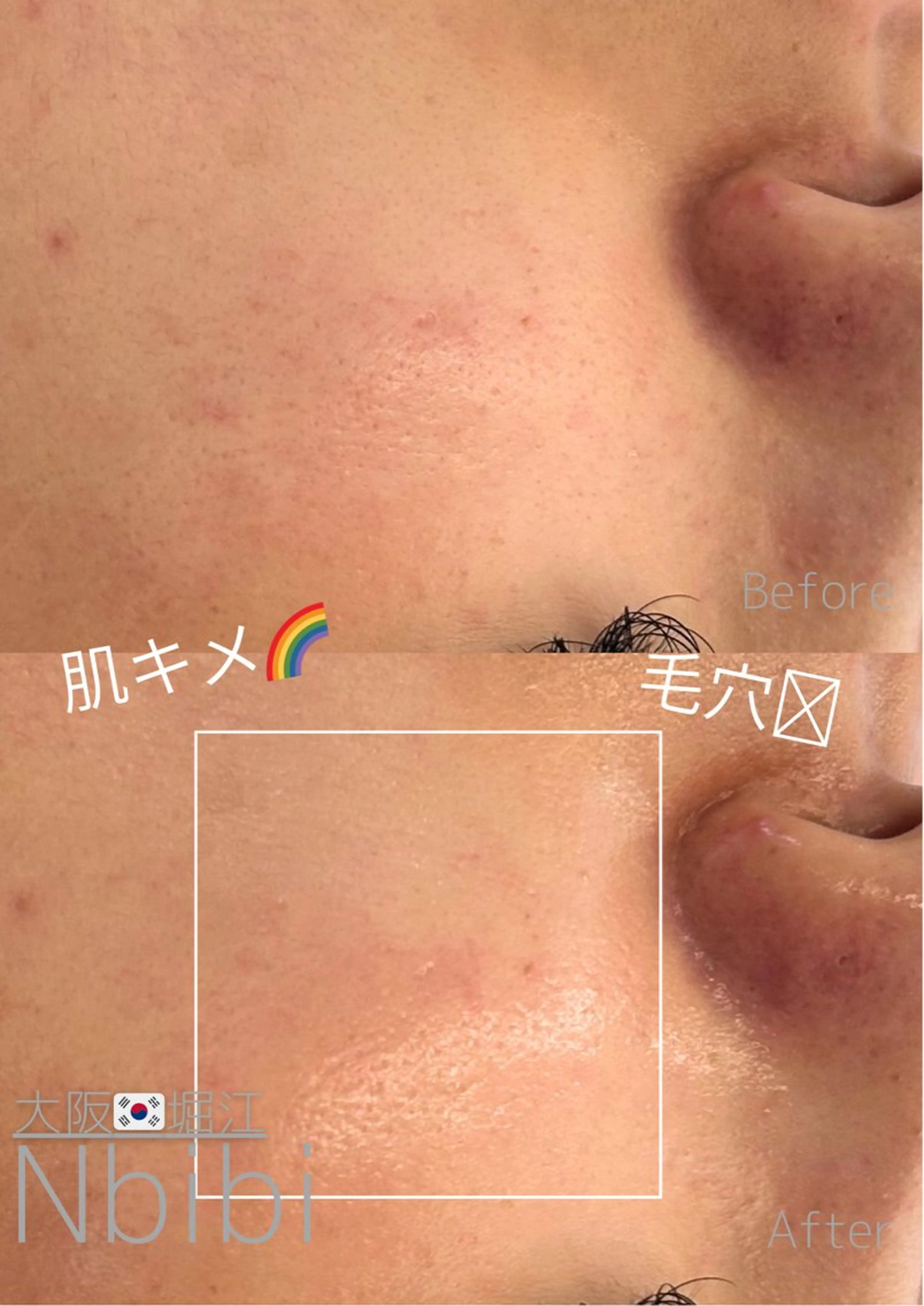 エステ 韓国🇰🇷価格 サロン_Nbibiのエステ・リラクイメージ