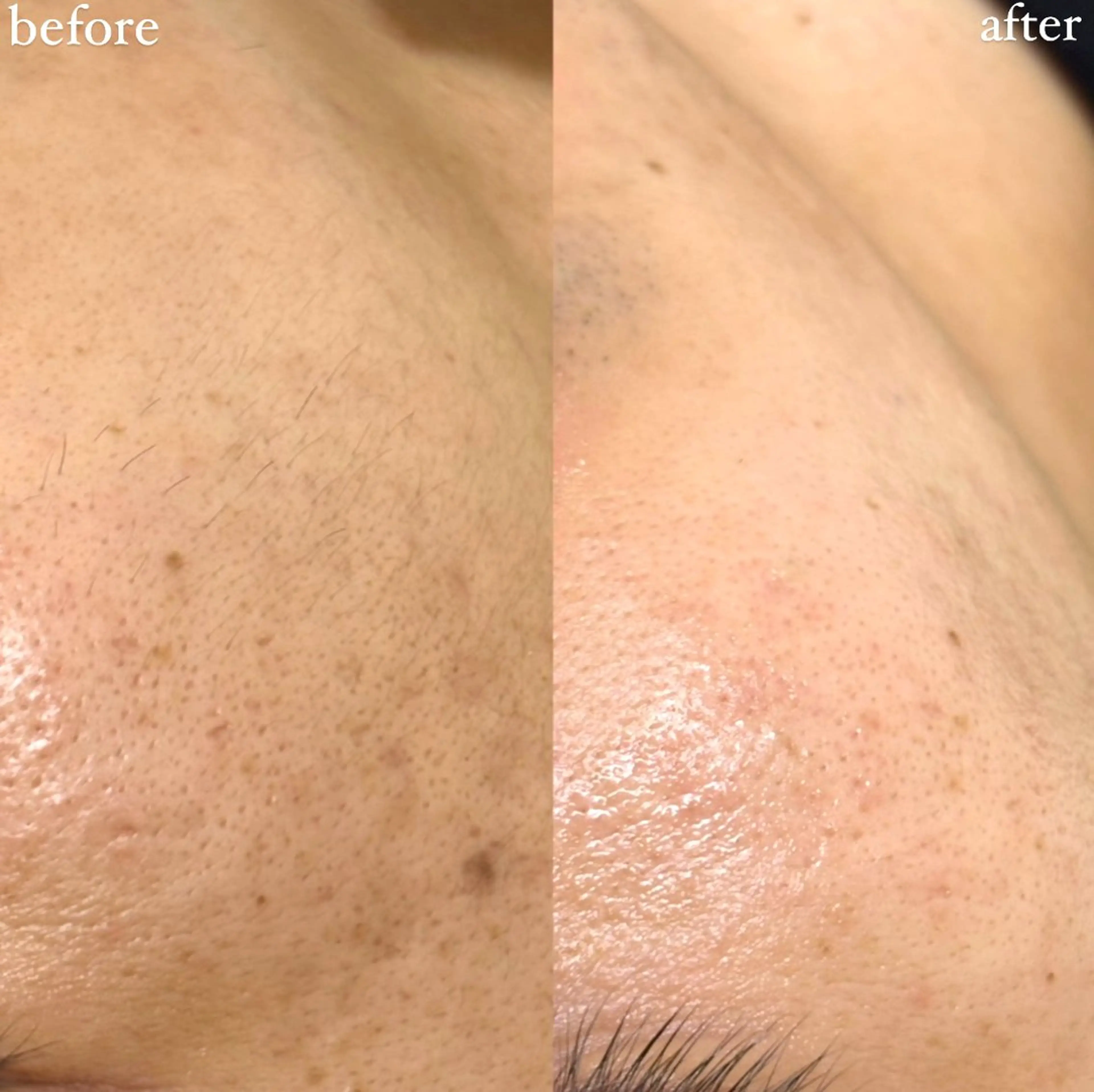 女性専門お顔剃り sunraineのエステ・リラクイメージ