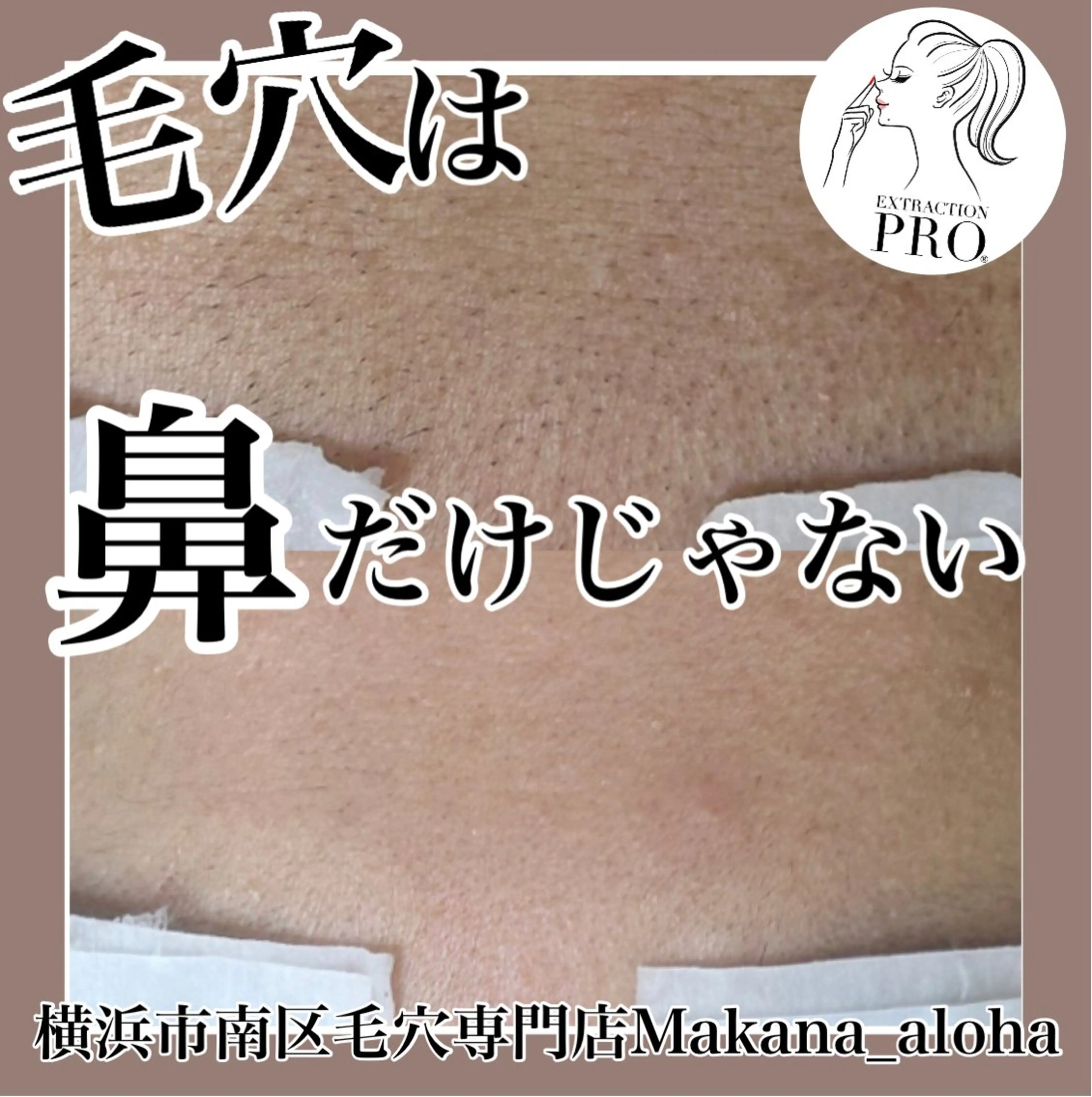 Makana_aloha所属・毛穴専門店 マカナアロハのエステ・リラクイメージ