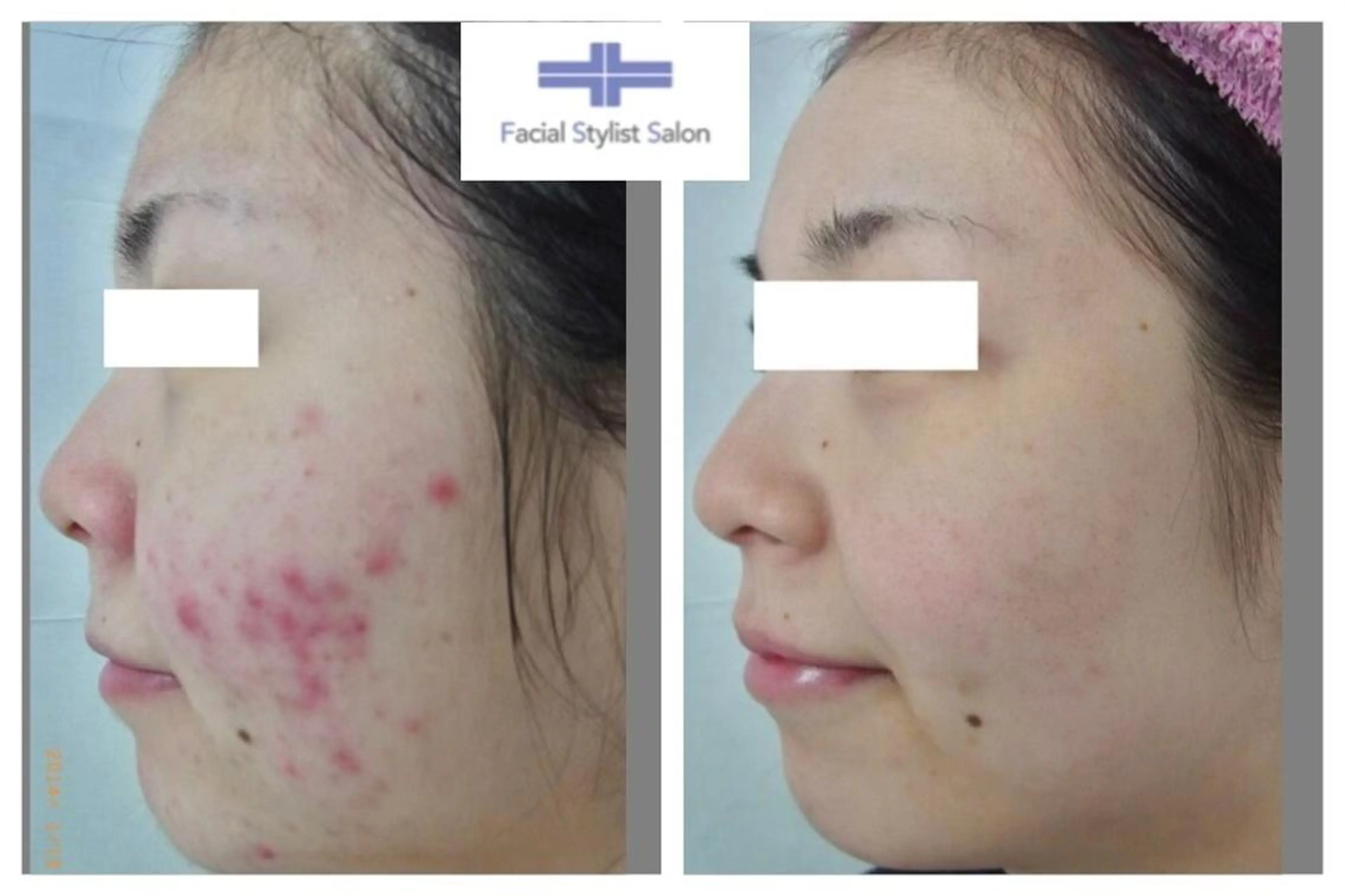 肌質改善専門サロン ／FSS渋谷店　松本のエステ・リラクイメージ