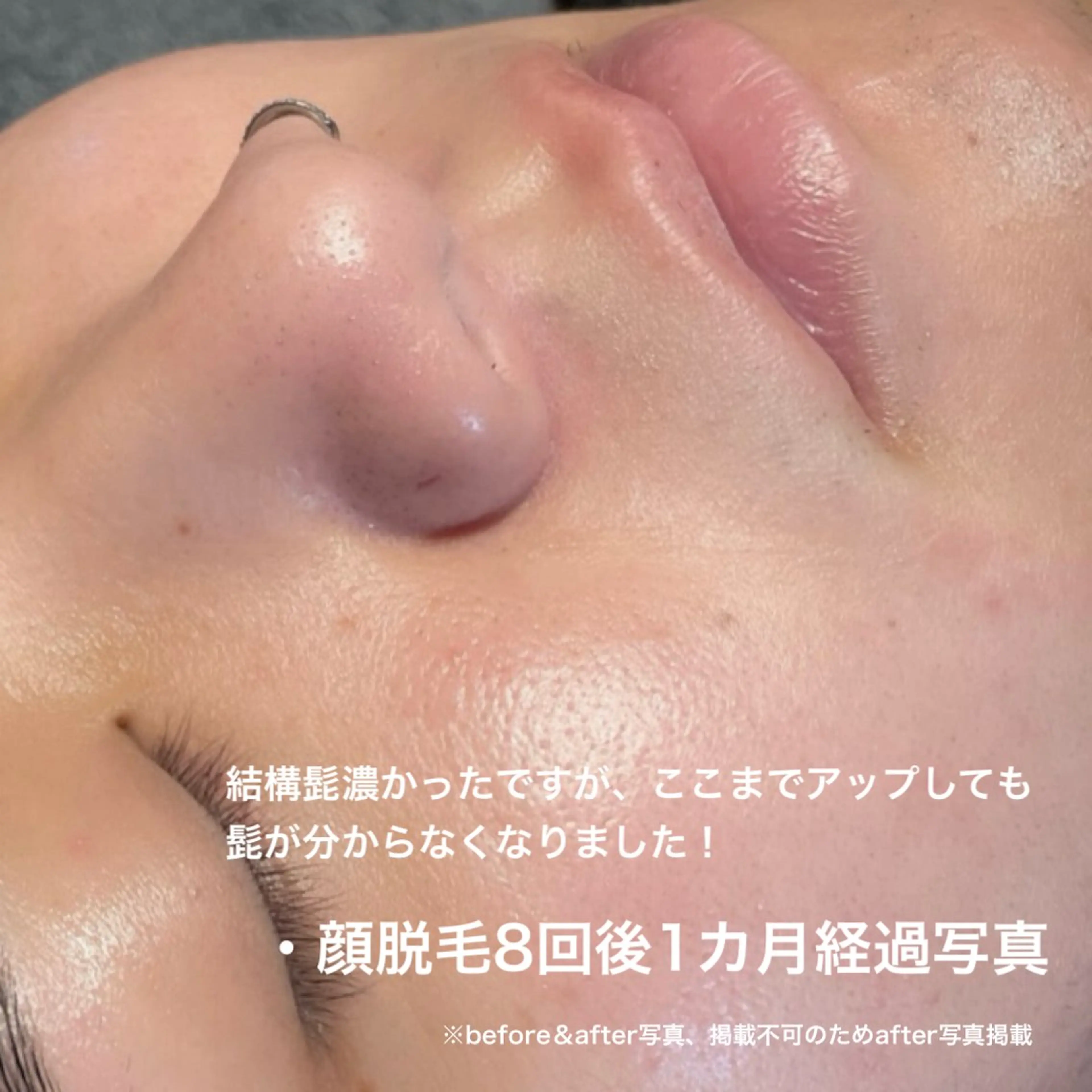 メンズ 脱毛 TEDDY BASE 眉＆脱毛サロンのエステ・リラクイメージ