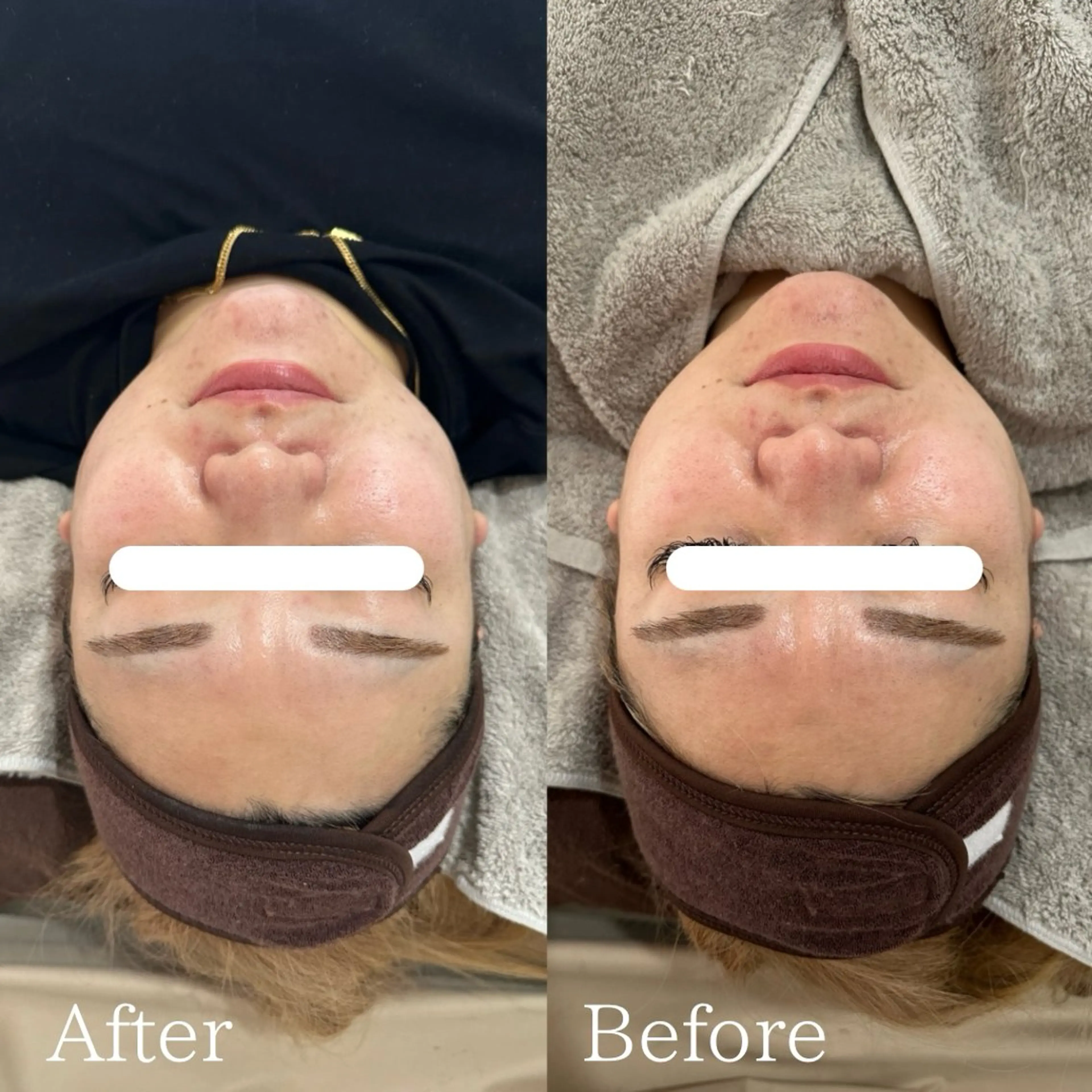 エステ lafleur Yurinaのエステ・リラクイメージ