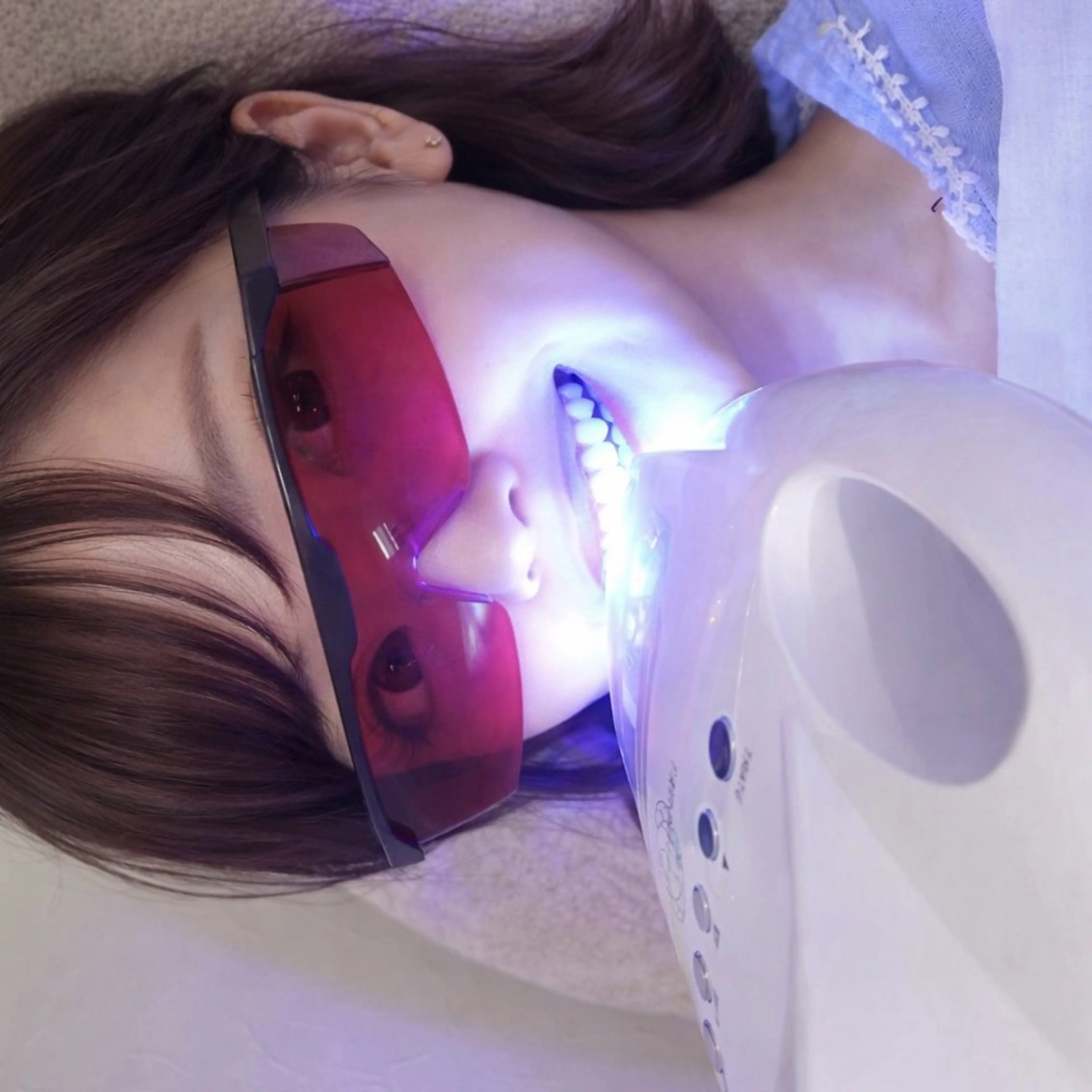 ✨初回限定✨セルフホワイトニング1回🦷《痛みなし/しみない》¥3,000の写真