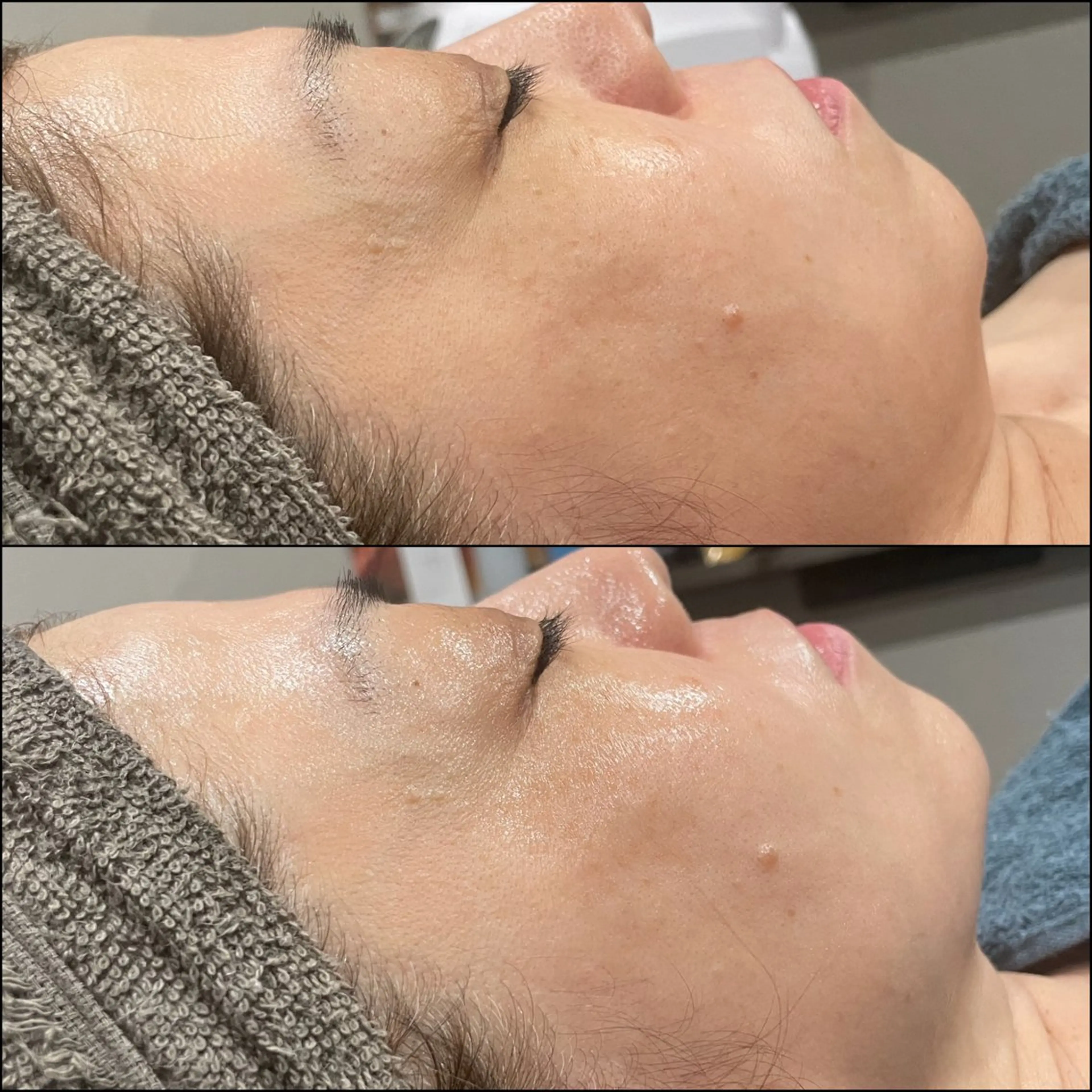 エステ LiZA エステティックサロンのエステ・リラクイメージ