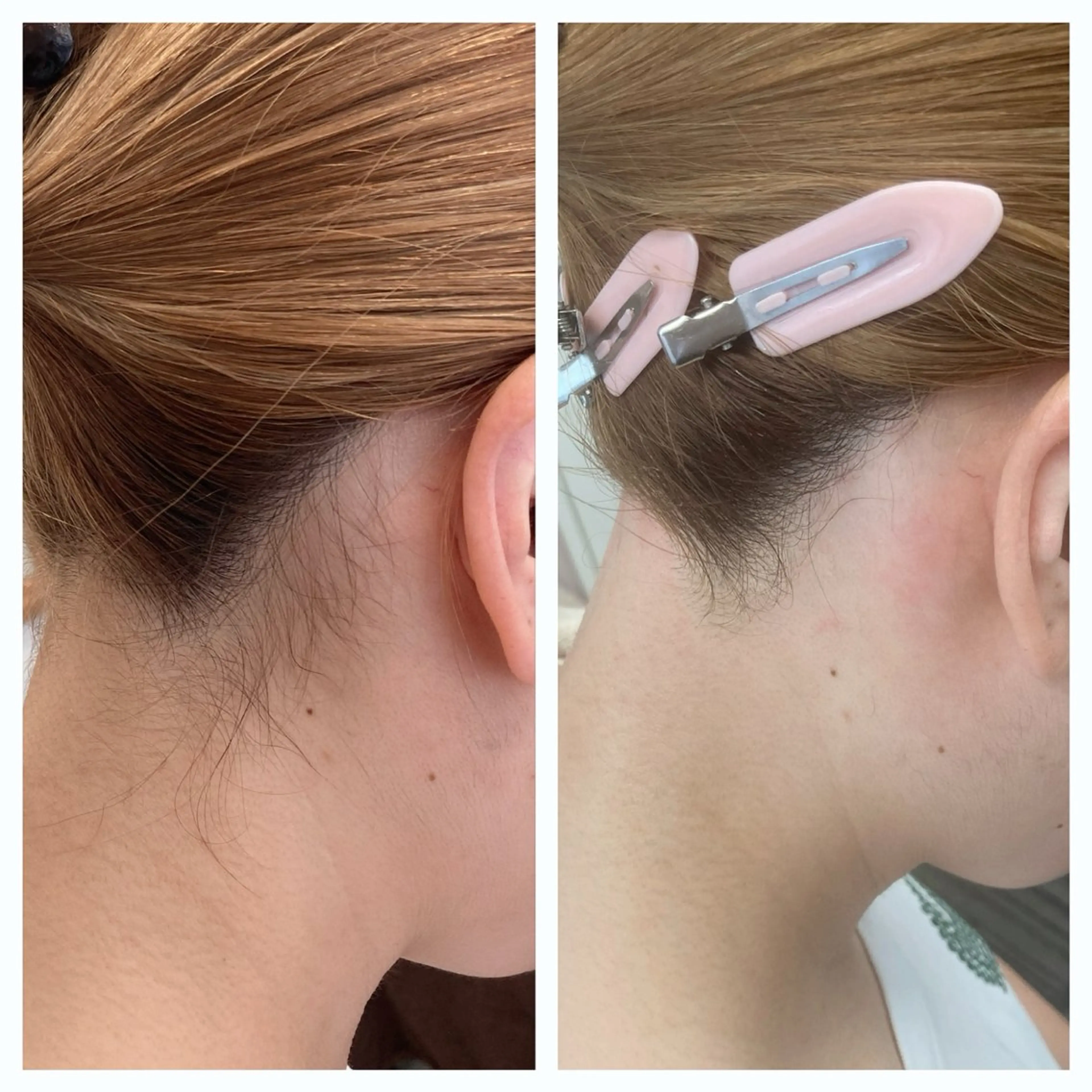 脱毛 meow by hug.所属・恵比寿🌻ワックス 顔うなじVIOワキのエステ・リラクイメージ