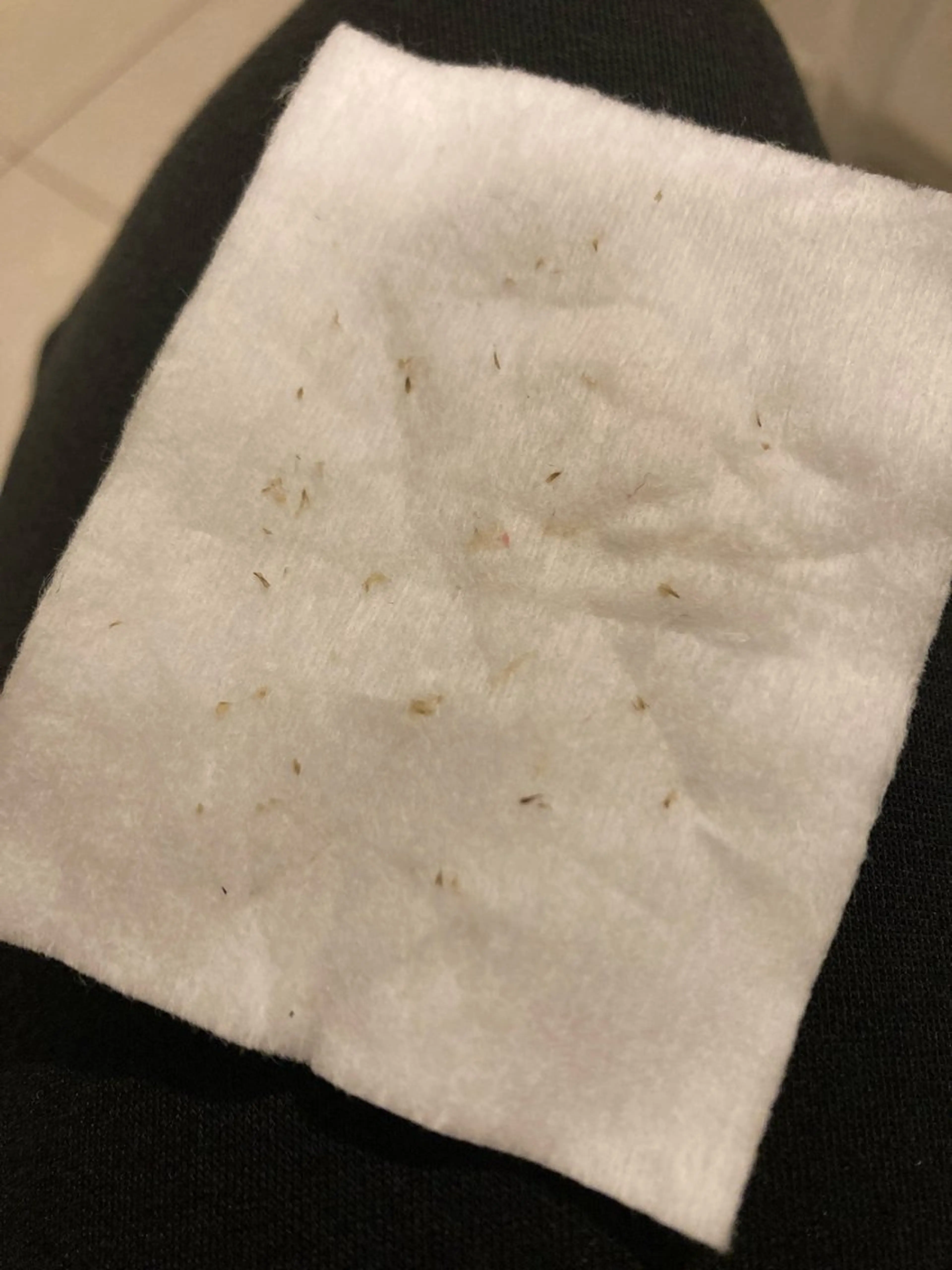 メンズ エステ Amm所属・🏆艶肌ワックス🏆 ララピール✨Ammのエステ・リラクイメージ