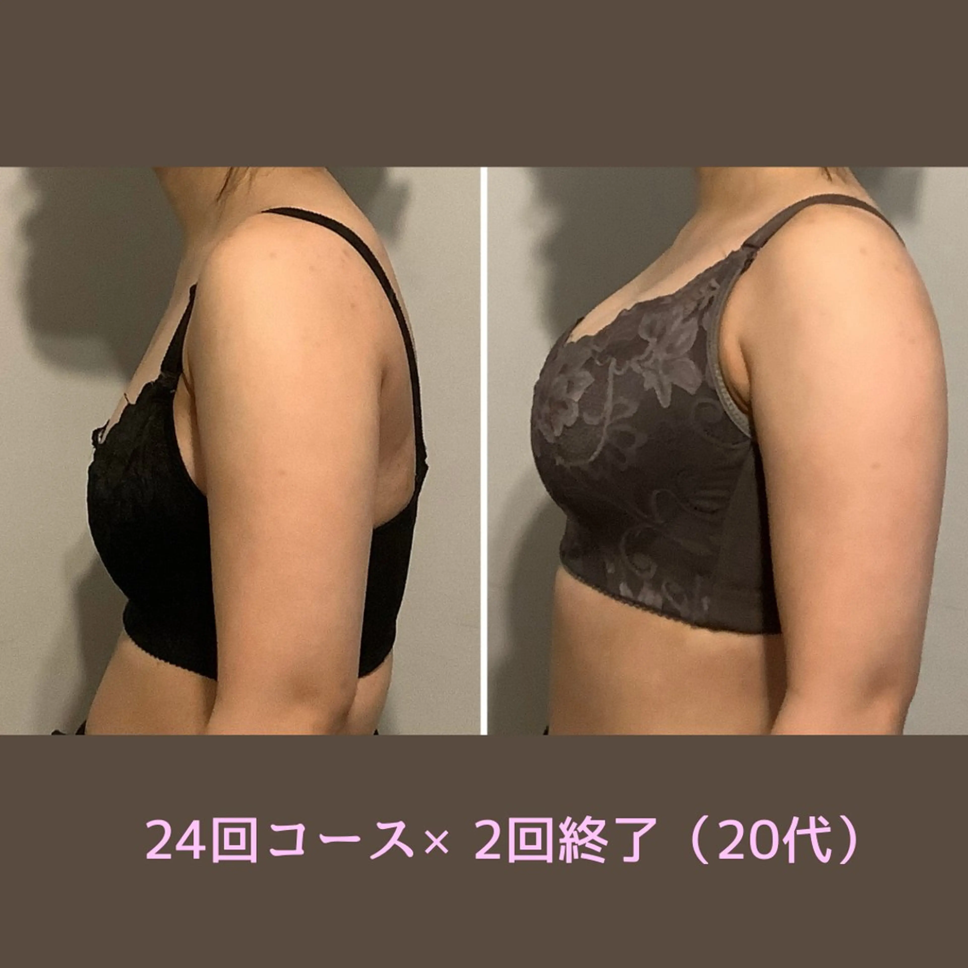 小顔＆ピーリング肌育 ふじこのきもちのエステ・リラクイメージ